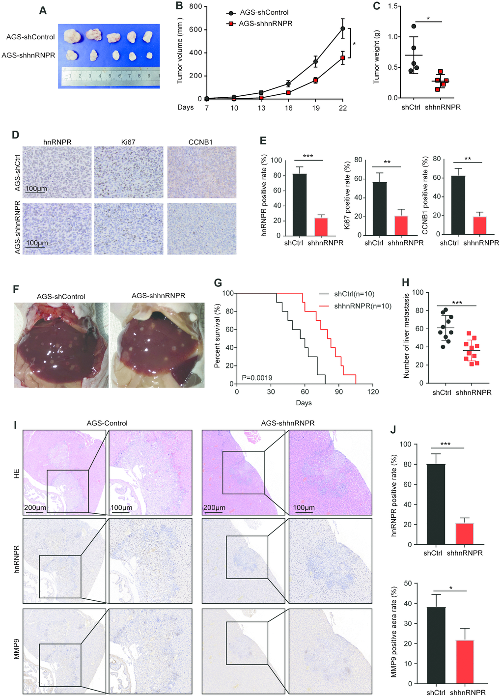 Repression of hnRNPR inhibits tumor growth and metastasis in vivo. (A) Tumor size and (B) tumor volumes in hnRNPR-knockdown and control groups. (C) Tumor weight in hnRNPR-knockdown and control groups (n=5). (D) Representative images (E) quantification of hnRNPR, Ki67, and CCNB1 in the indicated xenograft tumors. (F) Representative images of liver metastasis in the indicated tumors. (G) Kaplan–Meier curve of mice showing low expression of hnRNPR versus high expression of hnRNPR group. (H) Number of liver metastasis (I) representative image (J) Quantification of hnRNPR and MMP9 expression in the indicated xenograft tumors. P values were calculated with two-tailed unpaired Student’s t-test, or log rank Mantel-Cox test. *, P
