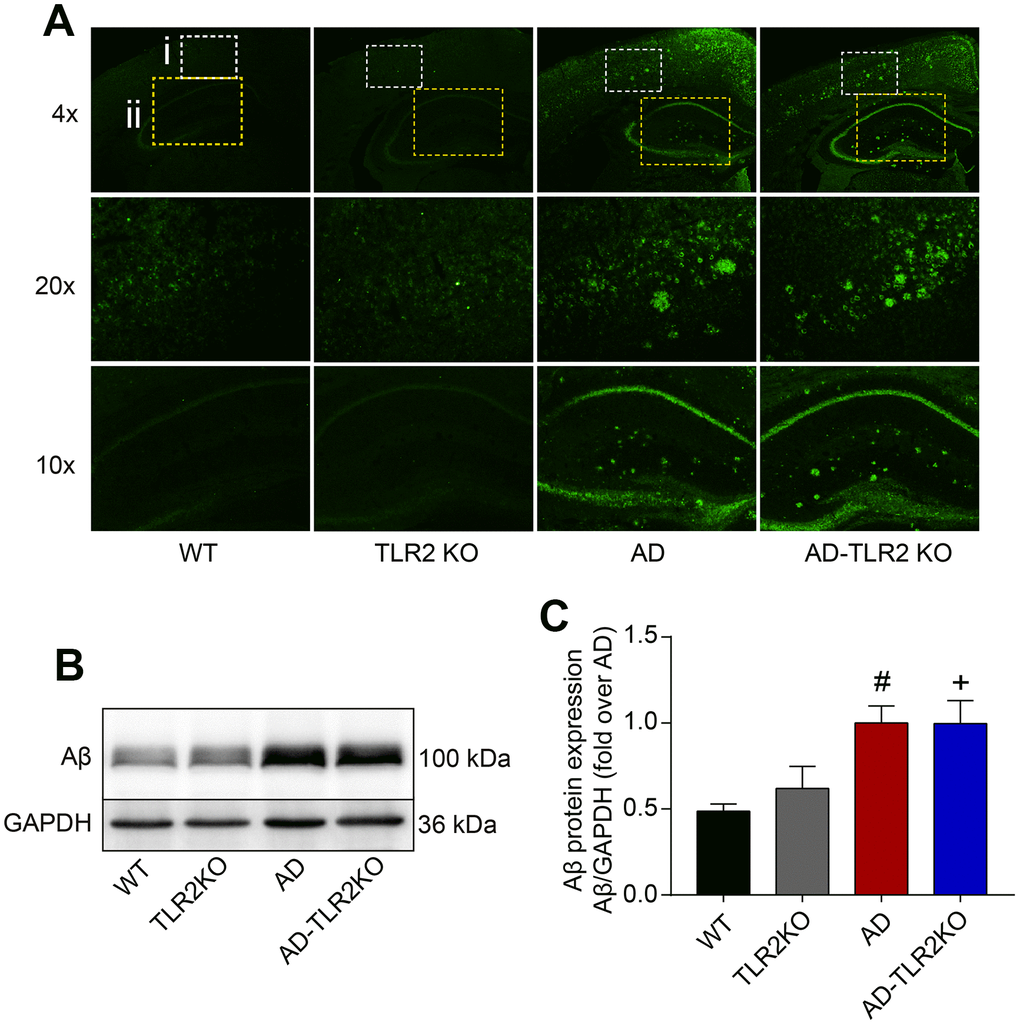 Aβ deposition in mouse brains. (A) Representative immunofluorescence images of Aβ deposition in mouse brains (4x, 20x: cortex; 10x: hippocampus). (B) Representative Aβ levels in brain tissues detected by Western blots. (C) Results from quantitative analyses of Western blots showed that Aβ levels were significantly higher in AD and AD-TLR2KO mice compared with WT and TLR2KO mice, respectively (#: AD vs. WT, p