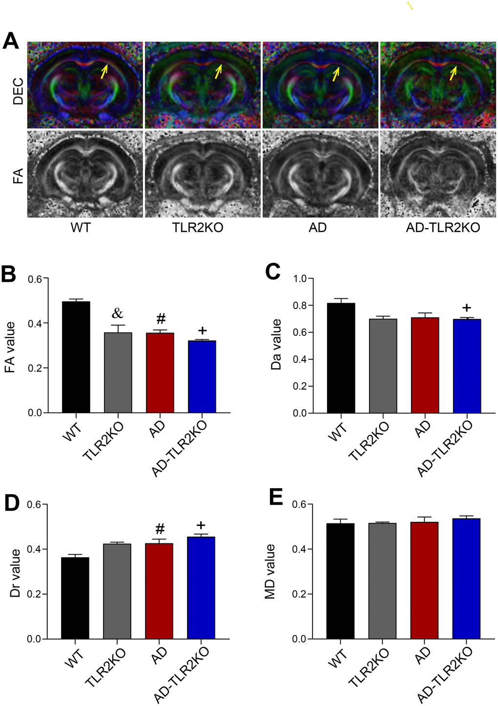 White matter integrity evaluated by DTI images detected by 7 Tesla MRI system. (A) Representative diffusion-encoded-color (DEC) map and fractional anisotropy (FA) map showing white matter injury (yellow arrow). (B) Quantitative analysis showed that the FA value significantly decreased in TLR2KO mice (&), AD mice (#), and AD-TLR2KO mice (+) compared with WT mice (pB). (C) Axial diffusivity (Da) value decreased in AD-TLR2KO mice compared with WT mice (+: pD) Radial diffusivity (Dr) value increased in AD (#) and AD-TLR2KO (+) mice compared with WT mice (pE) There was no significant deference in the mean diffusivity (MD) value among the groups. (n= 4~6 / group).