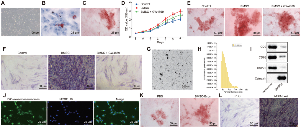 The exosomes derived from hBMSCs promote the activity of osteoblasts (hFOB1.19). (A) The morphology of BMSCs after 72 h of culture (100 ×). (B) Oil red O staining of BMSCs after adipogenic induction for 3 weeks (400 ×). (C) Alizarin red staining of BMSCs after osteogenic induction for 3 weeks (400 ×). (D) Detection of osteoblasts viability by CCK-8 assay. (E) Alizarin red staining of osteoblasts (200 ×). (F) ALP staining of osteoblasts (200 ×). (G) The morphology of exosome (200 nm) was observed under a TEM. (H) Analysis of particle size distribution and concentration in exosome by TRPS. (I) The protein expression of CD63, CD9, HSP70 and Calnexin measured by Western blot analysis. (J) The endocytosis of hFOB1.19 following 24 h of co-culture with exosomes observed with a confocal microscope (400 ×). (K) Alizarin red staining of osteoblasts (hFOB1.19) treated with BMSC-Exos (200 ×). (L) ALP staining of osteoblasts (hFOB1.19) treated with BMSC-Exos (200 ×). * p vs. PBS or control; # p vs. BMSCs. Data were expressed with mean ± standard error. In Panel D, the repeated measures analysis of variance was used for data analysis, followed by Tukey’s post hoc test. The experiment was repeated three times.