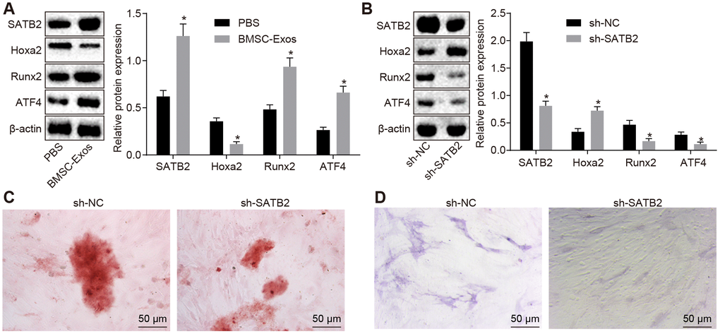 BMSC-Exos promote the protein expression of SATB2 in osteoblasts (hFOB1.19). (A) The protein expression of SATB2, Runx2, ATF4 and Hoxa2 in osteoblasts (hFOB1.19) treated with BMSC-Exos detected by Western blot analysis. (B) The protein expression of SATB2, Runx2, ATF4 and Hoxa2 in osteoblasts (hFOB1.19) treated with sh-SATB2 detected by Western blot analysis. (C) Alizarin red staining of osteoblasts (hFOB1.19) treated with sh-SATB2 (200 ×). (D) ALP staining of osteoblasts (hFOB1.19) treated with sh-SATB2 (200 ×). * p vs. sh-NC. Data were expressed with mean ± standard error. In Panel A and B, the unpaired t test was used for data analysis. The experiment was repeated three times.