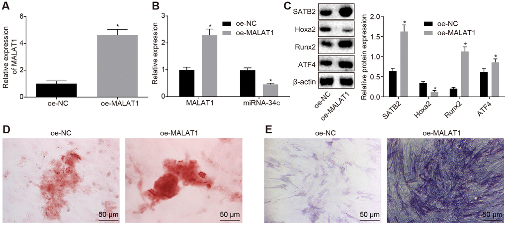 BMSCs-derived exosomal MALAT1 promotes osteoblast activity. (A) The MALAT1 expression in exosomes evaluated by RT-qPCR. (B) The MALAT1 and miR-34c expression in hFOB1.19 detected by RT-qPCR. (C) The protein expression of SATB2, Runx2, ATF4 and Hoxa2 in osteoblasts (hFOB1.19) treated with oe-MALAT1 detected by Western blot analysis. (C) Alizarin red staining of osteoblasts (hFOB1.19) treated with oe-MALAT1 (200 ×). L. ALP staining of osteoblasts (hFOB1.19) treated with oe-MALAT1 (200 ×). * p vs. oe-NC. Data were expressed with mean ± standard error. In Panel A–C, the unpaired t test was used for data analysis. The experiment was repeated three times.