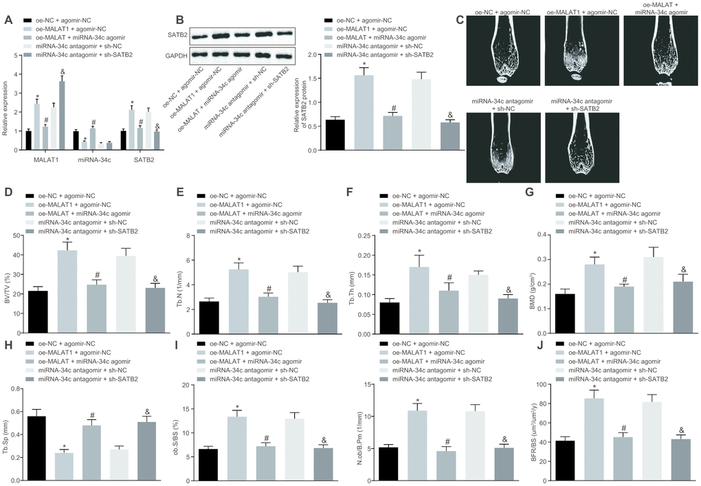 Upregulated MALAT1 alleviates the symptoms of osteoporosis in mice. OVX mice were injected with oe-MALAT1 + miR-34c agomir or miR-34c antagomir + sh-SATB2. (A) The MALAT1 and miR-34c expression as well as the mRNA expression of SATB2 in femoral tissue was detected by RT-qPCR. (B) The protein expression of SATB2 in femoral tissue by Western blot analysis. (C) Three-dimensional CT image of distal femur (1 mm). (D–H) Quantitative data of BV/TV (D), Tb.N (E), Tb.Th (F), BMD (G) and Tb.Sp (H) in distal femoral of mice. (I) Number of osteoblasts in vertebral body sections. (J) Calcitonin double labeling analysis. * p vs. oe-NC + agomir-NC; # p vs. oe-MALAT1 + agomir-NC; & p vs. miR-34c antagomir + sh-NC. Data were expressed with mean ± standard deviation. In Panel B–F, the unpaired t test was used for data analysis.