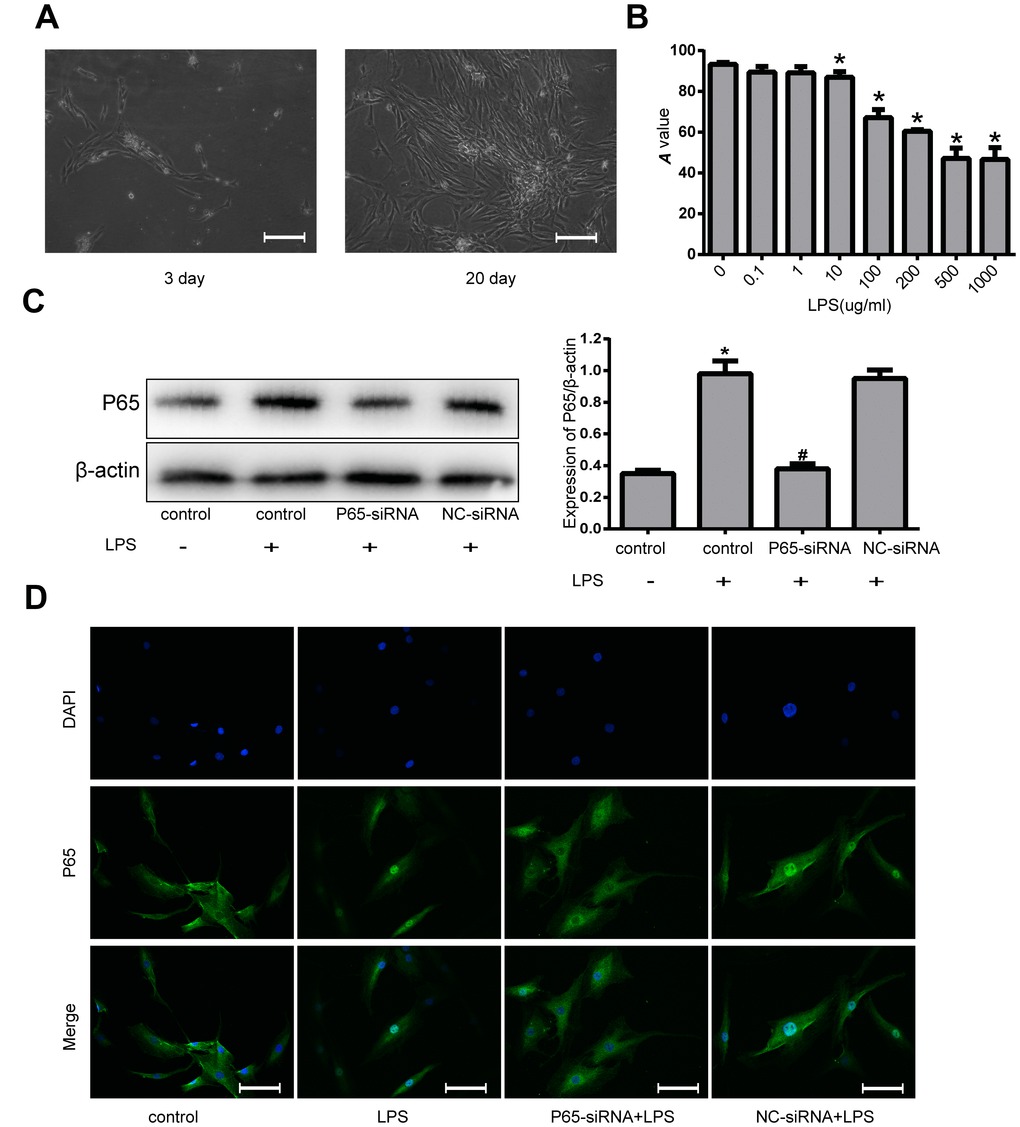 Effects of NF-κB inhibition and LPS on human NPCs. (A) The morphology of the primary NP cells was observed with inverted microscope (magnification ×200). (B) The viability of NPCs induced by various concentrations of LPS was measured by CCK-8. (C) Western blot analysis for the protein expression of P65. (D) The nuclear translocation of P65 was measured by Fluorescence immunocytochemistry (magnification ×200). Values are means ±SEM.*p#p