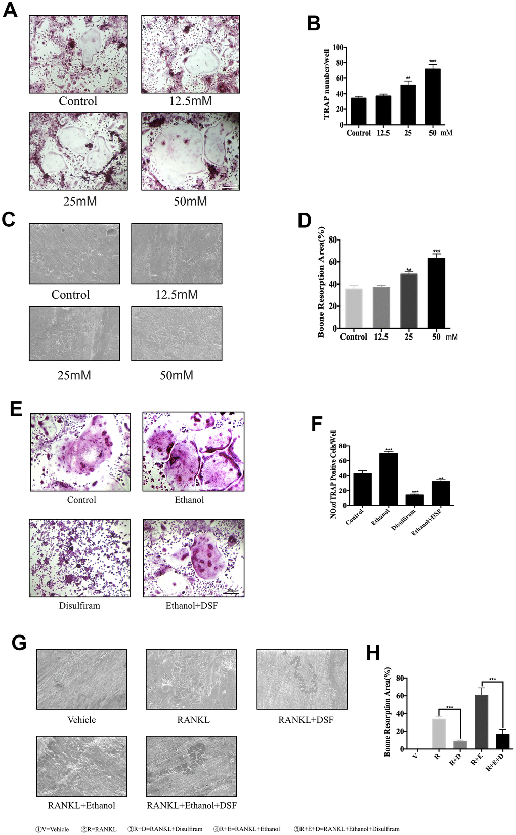 Ethanol increases RANKL-induced OC formation and bone resorption in vitro. (A) BMMs were stimulated with RANKL at different concentrations of ethanol and histochemically stained for TRAP detection. TRAP-positive cells with ≥3 nuclei were considered as OCs. (B) Numbers and areas of TRAP-positive multinucleated (>3 nuclei) cells formed in the presence of increasing concentrations of ethanol (n = 3). (C) Equal number of pro-osteoclasts were cultured on bone slices in the presence of different concentrations of ethanol. After 5 days, bone resorption lacunae were observed by scanning electron microscopy. (D) Area of bone resorption was measured using ImageJ software. (E) Disulfiram dramatically inhibited RANKL-induced osteoclastogenesis. TRAP-positive cells with ≥3 nuclei were considered OCs (magnification 100×; scale bar = 200 μm). (F) Analysis of the numbers and areas of TRAP-positive multinucleated (>3 nuclei) cells (n = 3). (G) Equal number of pro-osteoclasts were cultured on bone slices treated with indicated condition. After 5 days, bone resorption lacunae were observed by scanning electron microscopy. (H) Area of bone resorption was measured using ImageJ software. Data are the mean ± SD. *p p p 