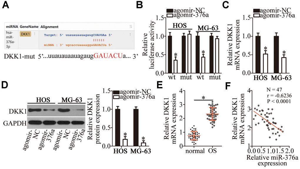 DKK1 mRNA is a direct target of miR-376a in OS cells. (A) MiR-376a and its wild-type binding site in the 3′-UTR of DKK1 mRNA. The mutations were introduced into the site complementary to the seed region of miR-376a. (B) The luciferase reporter assay was performed to test whether the 3′-UTR of DKK1 mRNA could be directly targeted by miR-376a in OS cells. HOS and MG-63 cells were cotransfected with either agomir-376a or agomir-NC and either the DKK1-wt or DKK1-mut plasmid. After 48 h of cultivation, the transfected cells were assayed with the Dual-Luciferase Reporter Assay System to measure the luciferase activity. *P C, D) Expression levels of DKK1 mRNA and protein in miR-376a-overexpressing HOS and MG-63 cells were respectively determined by RT-qPCR and western blotting. *P E) RT-qPCR was carried out to measure DKK1 mRNA expression in the 47 pairs of OS tissue samples and adjacent-normal-bone tissue samples. *P F) Spearman’s correlation analysis confirmed the negative correlation between DKK1 mRNA and miR-376a levels among the OS tissues. r = -0.6236, P 