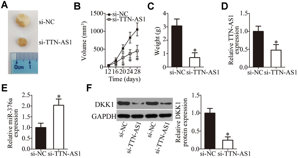 TTN-AS1 downregulation restricts tumor growth of OS cells in vivo. (A) Representative images captured at 4 weeks after subcutaneous injection of si-TTN-AS1-transfected or si-NC-transfected HOS cells into the flank of nude mice. (B) Tumor growth curves show that tumors grew significantly more slowly in the si-TTN-AS1 group than in the si-NC group. *P C) The average weight of tumor xenografts collected in groups si-TTN-AS1 and si-NC was analyzed at 4 weeks after the inoculation. *P D, E) The expression levels of TTN-AS1 and miR-376a in the tumor xenografts were measured by RT-qPCR. *P F) DKK1 protein expression was measured in the tumor xenografts by western blotting. *P 