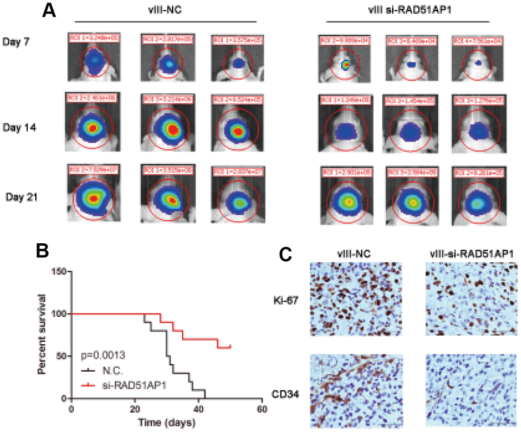 Target knocking down RAD51AP1 inhibited the progression of the EGFRvIII-positive intracranial GBM model. (A) The tumor volumes at the indicated times were evaluated by bioluminescence imaging. (B) Survival rates of mice bearing U87-EGFRvIII and EGFRvIII-siRAD51AP1 tumors. (C) Immunohistochemistry analysis was performed to detect Ki-67 and CD34 expression.