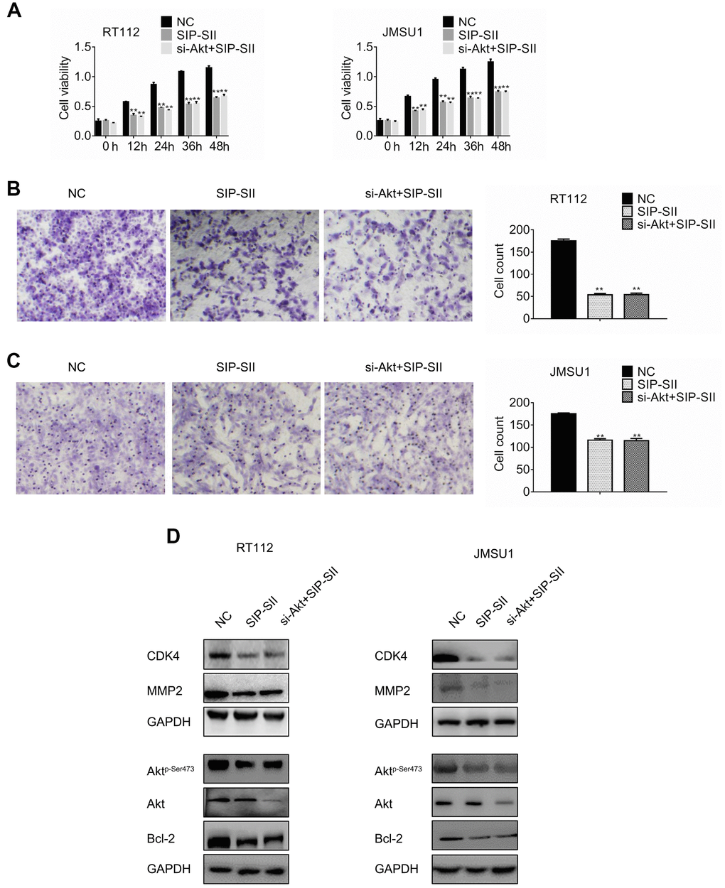 SIP-SII hampers proliferation and migration of bladder cancer cells in an Akt-dependent manner. (A) Cell viability (MTT) assay results for RT112 and JMSU1 cells treated with negative control siRNA (NC), 5.0 μM SIP-SII, or dual treatment with SIP-SII and Akt siRNA (si-Akt) for 24 h. Cell migration assay results for RT112 cells (B) and JMSU1 cells (C) treated with SIP-SII alone or in combination with si-Akt for 24 h. Representative images at 200x magnification. Data are mean ± SD (error bars) of three experiments performed in triplicate. **P D) and JMSU1 (E) cells treated with DMSO, SIP-SII, or the combination of SIP-SII and si-Akt for 24 h.
