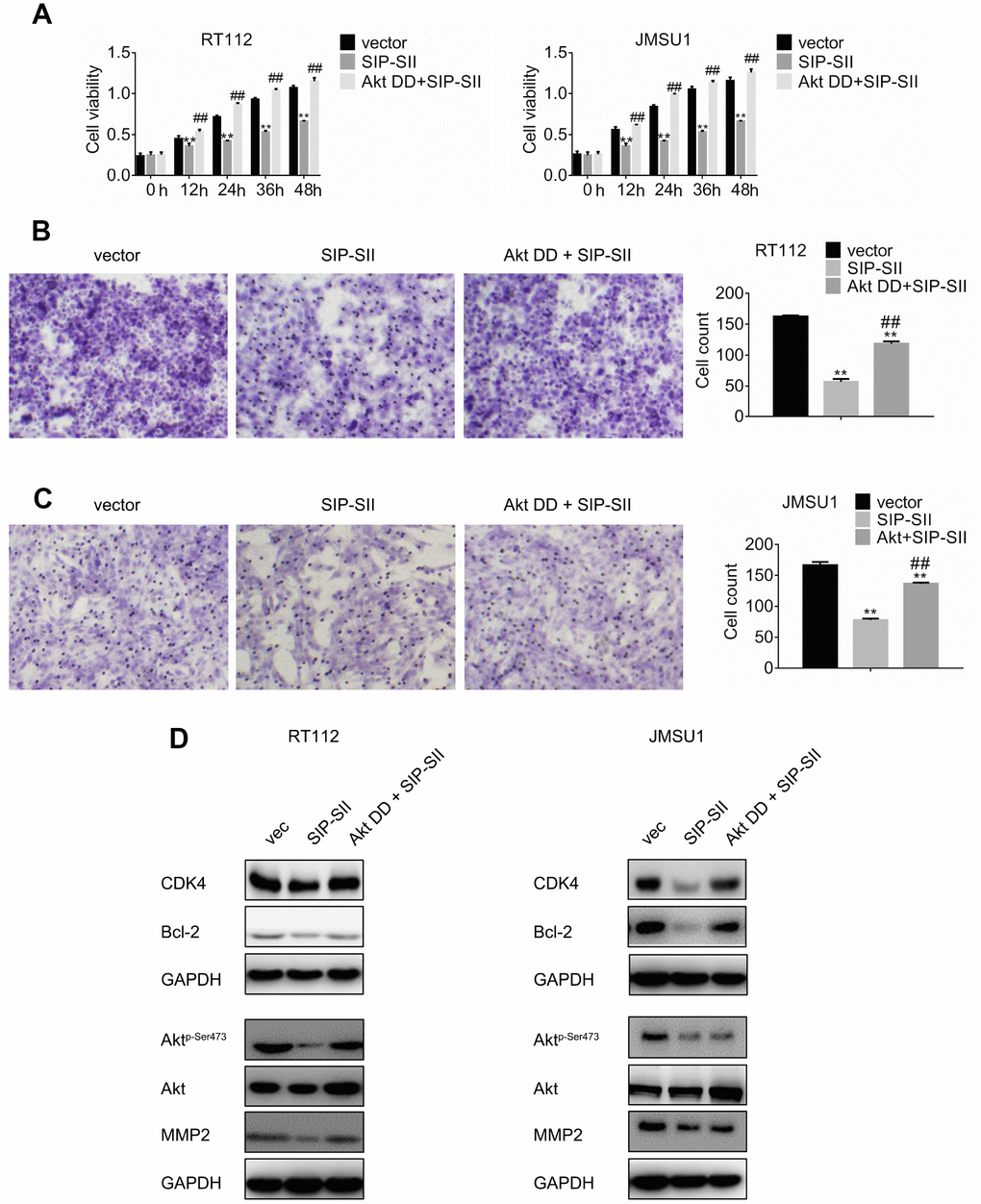 Overexpression of Akt DD abrogates SIP-SII inhibitory effects. (A) Cell viability assay results for RT112 and JMSU1 cells treated with the FLAG-HA empty vector and DMSO (control), 5.0 μM SIP-SII, or SIP-SII combined with Akt DD (PKB T308D S473D) for 24 h. Cell migration assay results for RT112 (B) and JMSU1 cells (C) treated with SIP-SII alone or in combination with Akt DD for 24 h. Representative images at 200x magnification. Data are mean ± SD (error bars) of three experiments performed in triplicate. **P D) and JMSU1 (E) cells treated with SIP-SII alone or in combination with Akt DD for 24 h.