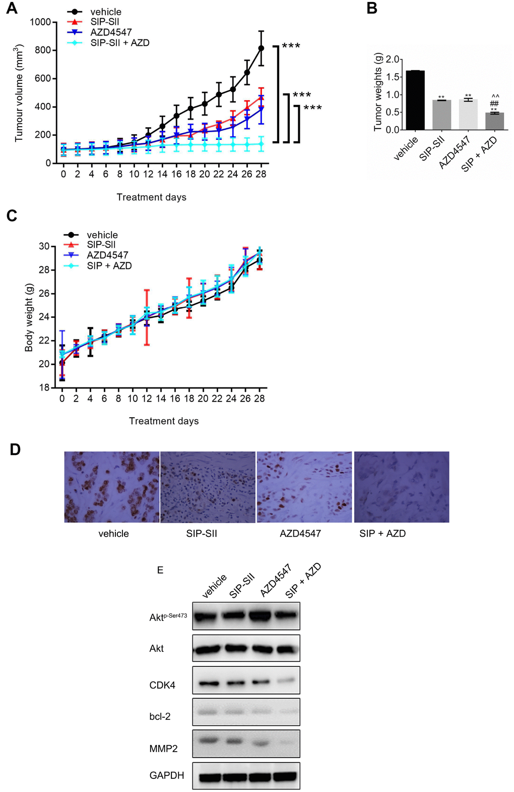 Combination of SIP-SII and AZD4547 enhances growth suppression of RT112 xenografts. Nude mice were randomly divided into four experimental groups after subcutaneous injection of RT112 cells. (A) Tumor volume measurements. (B) Tumor weight measurements after euthanasia on day 28 post-treatment initiation. (C) Body weight measurements. ***P D) Immunohistochemical staining of phospho-Akt in excised tumors (vehicle, SIP-SII, AZD4547, and combination therapy). Representative images at 100x magnification. (E) Western blot analysis of tumor samples.