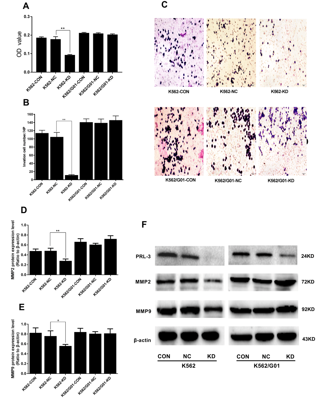 Effects of PRL-3-silencing on cell migration and invasion were evaluated in K562 and K562/G01 cells. (A) The OD values (proportional to cell numbers) of migrated cells were measured by MTS assay. (B) The invasion cell numbers were counted under microscope in five HP fields. (C) Wright-Giemsa stained invasion cells were observed under microscope (×200). (D, E) Quantification of MMP2 and MMP9 were normalized to β-actin. (F) MMP2, MMP9, PRL-3 and β-actin expression by western blot. (*PPvs. NC group).