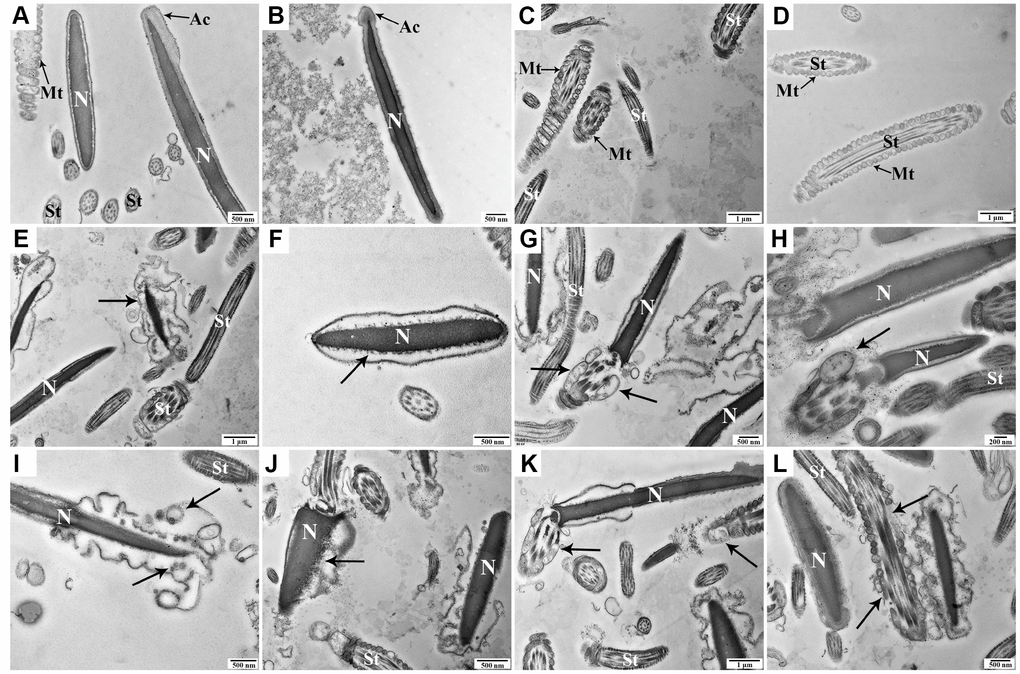 Transmission electron microscopy images of morphologic changes in goat spermatozoa at 0 h (A–D), 48 h (E–H), and 96 h (I-L) of liquid storage. (A, B) Spermatozoa exhibited the normal ultrastructure. (C, D) Morphologically intact mitochondria. (E) Membrane blebbing. (F) Nuclear envelope defects. (G, H) Mitochondrial swelling, vacuolation, and deformity. (I) Membrane blebbing and apoptotic body formation. (J) Nuclear fragmentation. (K, L) Mitochondrial swelling, vacuolation, deletion, and disordered arrangement. Nuclear (N), acrosome (Ac), spermatozoa tail (St), and mitochondria (Mt). Scale bar = 1 μm (C, D, E, K), 500 nm (A, B, F, G, I, J, L), and 200 nm (H).