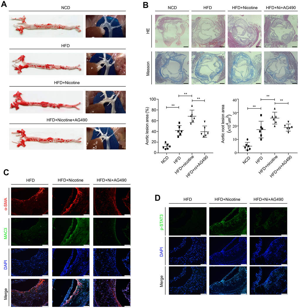 Inactivation of STAT3 attenuates nicotine-induced plaque development in vivo. (A) Lesions in en face aortas, as determined by oil red O staining and imaging. Arrow means atherosclerotic lesion. (B) Lesions in aortic root cross-sections, as determined by HE and Masson staining. Magnification, 100×; bars, 200 μm. (C) The components of atherosclerotic lesions were determined by a-SMA and Mac3 staining. Magnification, 200×; bars, 100 μm. (D) The expression of p-STAT3 in atherosclerotic lesions. Magnification, 200×; bars, 100 μm. Abbreviations: NCD, normal chow diet; HFD, high fat diet; Ni, nicotine. The data were presented as the mean ± SD, *p p 