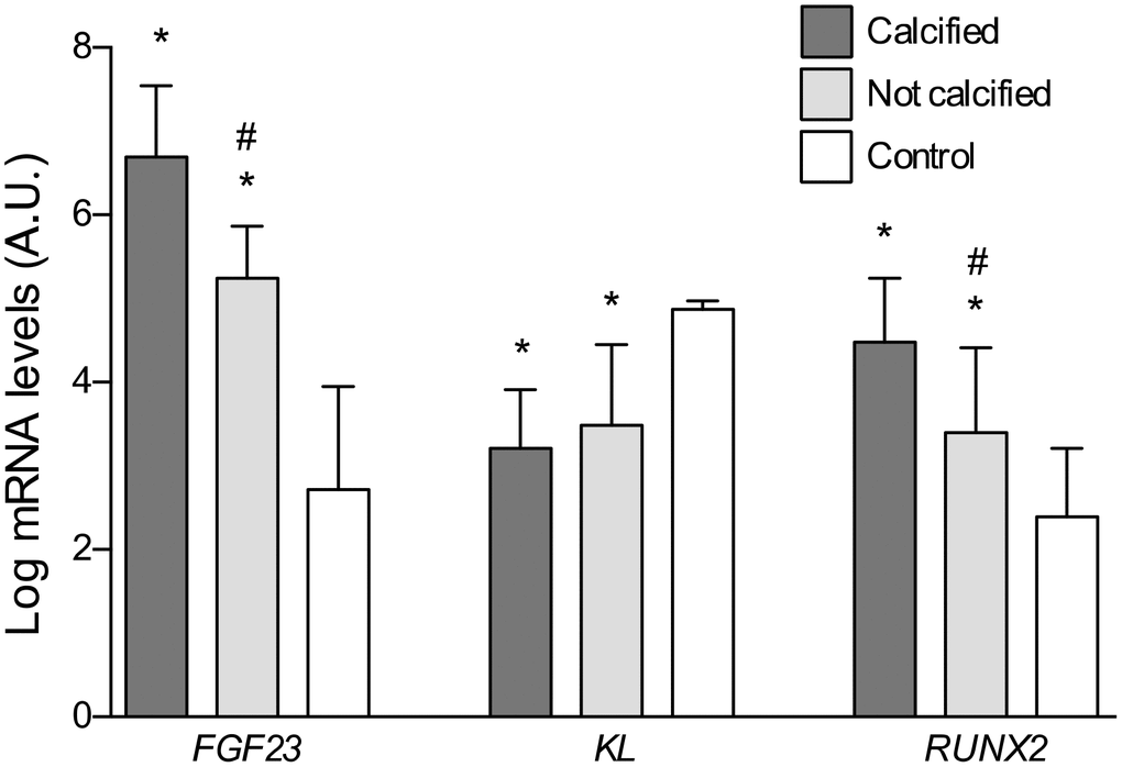 Differences in the log-transformed gene expression levels of FGF23, Klotho, and RUNX2 attending to the presence of calcification. *P
