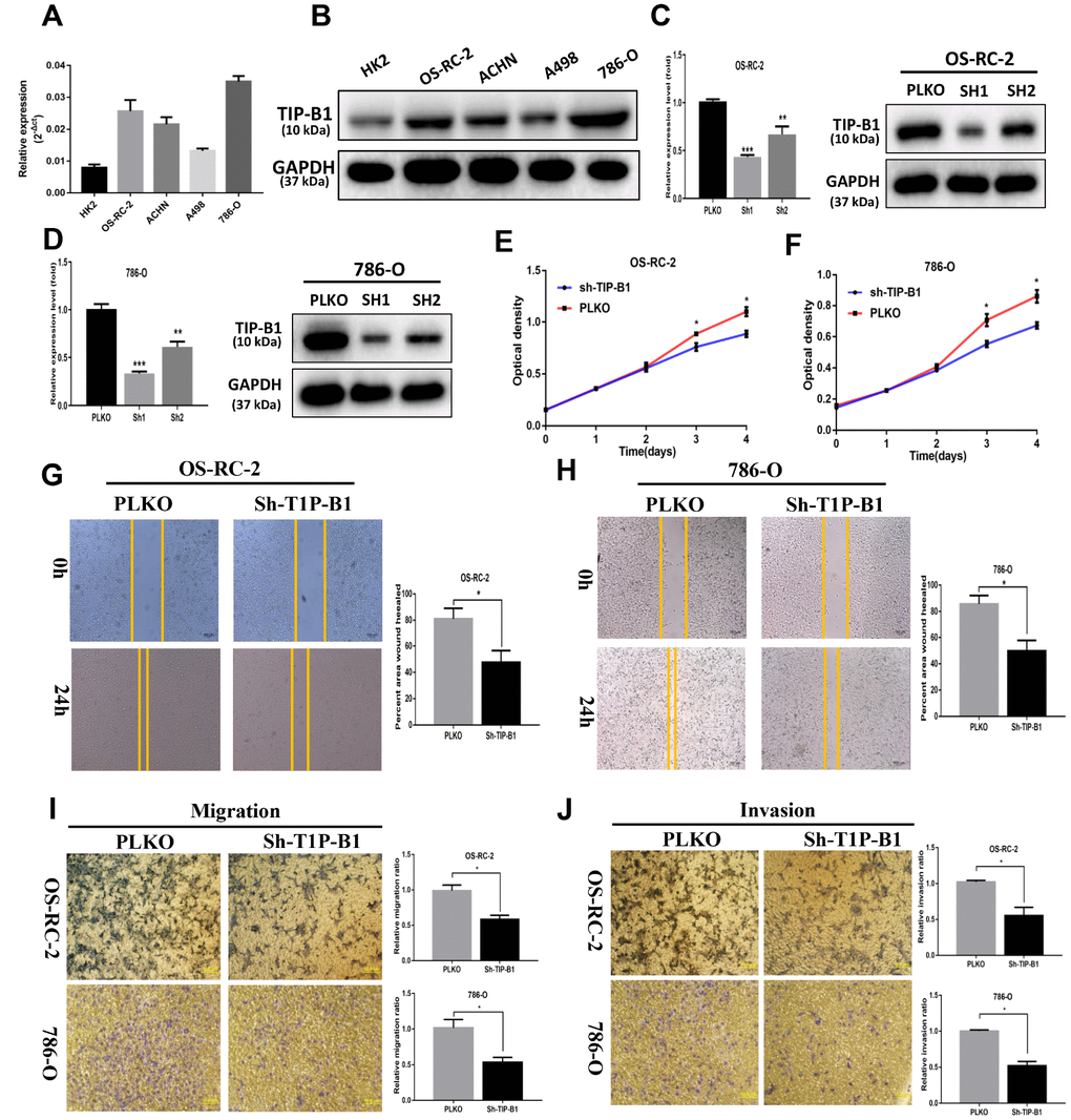 TIP-B1 promotes proliferation, migration and invasion of KIRC cells. (A) mRNA level of TIP-B1 in different KIRC cell lines and normal HK2 cell line. (B) protein level of TIP-B1 in different KIRC cell lines and normal HK2 cell line. (C–D) Efficiencies of TIP-B1 knockdown in OS-RC-2 cells (C) and 786-O cells (D) were validated by RT-PCR (left) and western blot(right) assays. (E–F) Cell proliferation was analyzed by CCK8 assay in OS-RC-2 cells (E) and 786-O cells (F). (G–H) Wound-healing assay after TIP-B1 knockdown in OSRC-2 (G) and 786-O (H) cells when compared to that of pLKO control cells. (I–J). Transwell migration (I) and invasion (J) assay after TIP-B1 knockdown in OSRC-2 (I) and 786-O (J) cells when compared to that of control cells.