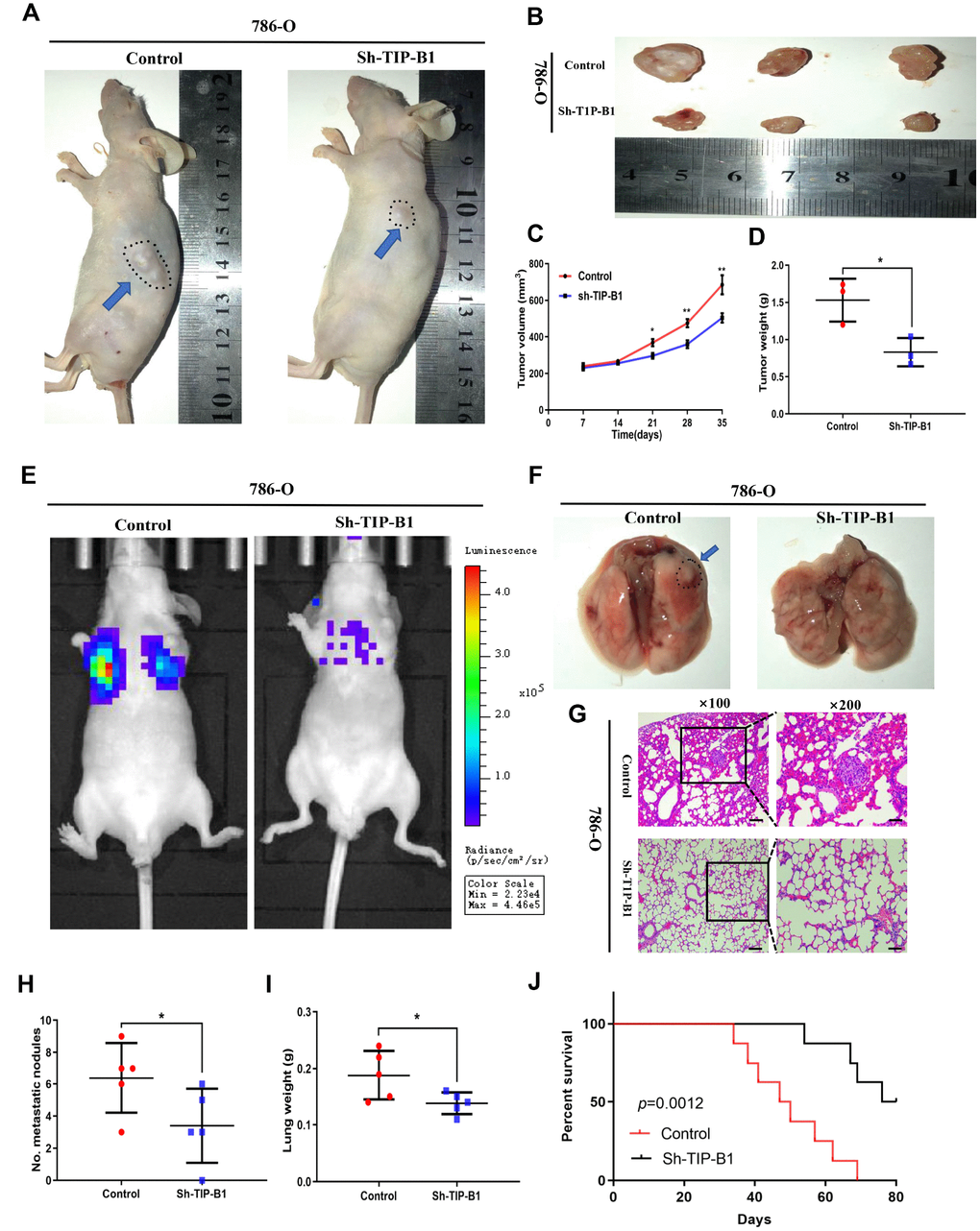 TIP-B1 knockdown inhibits KIRC tumor growth and metastasis. (A) Representative images of xenografts (arrows) were taken 5 weeks after injection. (B) The gross of tumors in sh-TIP-B1 and control groups. (C–D) Analysis of tumor volume (C) and weight (D) of xenograft tumors. (E) Representative images of metastasis by an in vivo bioluminescence imaging system. (F) Macroscopic appearance of lung metastatic nodule(arrows). (G) HE images of pulmonary micrometastases. (H) the number of pulmonary metastasis were compared. (I) Weights of the lung were compared. (J) Mouse survival curves.