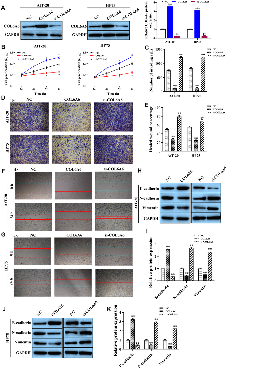 The effect of COL6A6 on the proliferation, invasion, migration, and EMT of AtT-20 and HP75 cells. (A) The expression of COL6A6 protein was determined by western blotting; (B) The proliferation ability of AtT-20 and HP75 cells were measured by CCK-8 assay; (C and D) The invasion of AtT-20 and HP75 cells were measured by Transwell assay (40×); (E–G) The migration ability of AtT-20 and HP75 cells were evaluated by wound healing assay (4×); (H–K) The expression of EMT related proteins in AtT-20 and HP75 cells were detected by western blotting. *P**P***P