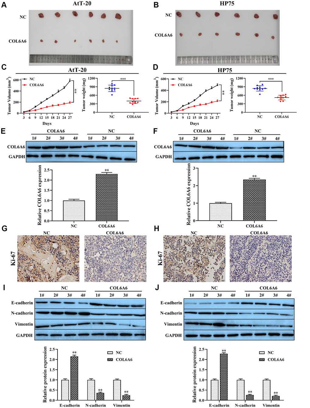 The effect of COL6A6 on the growth and metastasis of xenograft tumor. (A and B) The tumor size was obtained from nude mice; (C and D) Tumor volume and tumor weight of nude mice were analyzed; (E and F) The expression of COL6A6 in xenograft tumor tissues were detected by western blotting; (G and H) The expression of Ki-67 in xenograft tumor tissues were detected by immunohistochemistry staining; (I and J) The expression of E-cadherin, vimentin, and N-cadherin were measured by western blotting. **P***P