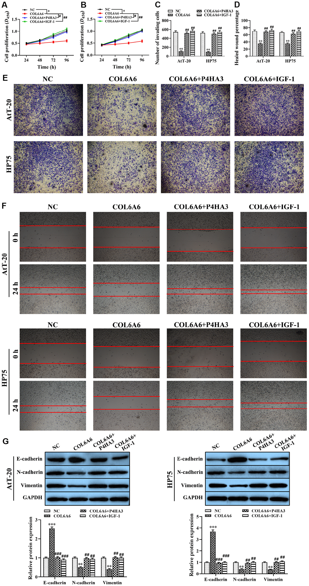 The effect of COL6A6 interacted with P4HA3 on the proliferation, invasion, migration, and EMT of AtT-20 and HP75 cells through regulating the PI3K-Akt pathway. (A and B: The proliferation ability of AtT-20 and HP75 cells were measured by CCK-8 assay; (C and E) The invasion of AtT-20 and HP75 cells were measured by Transwell assay (40×); (D and F) The migration ability of AtT-20 and HP75 cells were evaluated by wound healing assay (4×); (G) The expression of EMT related proteins in AtT-20 and HP75 cells were detected by western blotting. *P**P***P#P##P###P