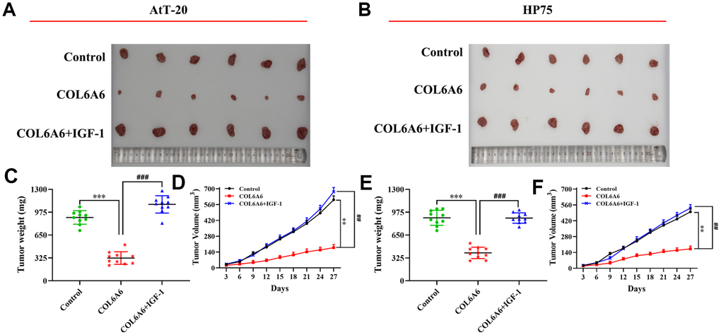 The effect of COL6A6 on the growth and metastasis of xenograft tumor by mediating PI3K-Akt pathway. (A and B) The tumor size was obtained from nude mice; C and E: The tumor weight was measured; (D and F) The tumor volume curve of nude mice was analyzed. **P***P##P###P