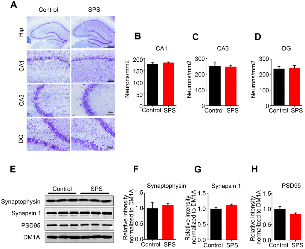 SPS does not influence neuronal and/or synaptic density. (A) Hippocampal sections were stained by Nissl staining to assess neuronal density (upper row scale bar=500μm, middle and lower row scale bar=100μm). (B–D) Quantitative analysis was performed, and SPS didn’t induce the neuronal death in CA1(B), CA3(C) and DG(D). (E–H) WB analysis showed no significant changes in the level of synaptophysin, synapsin1 and PSD95. Data are presented as mean ± SEM, n=3.