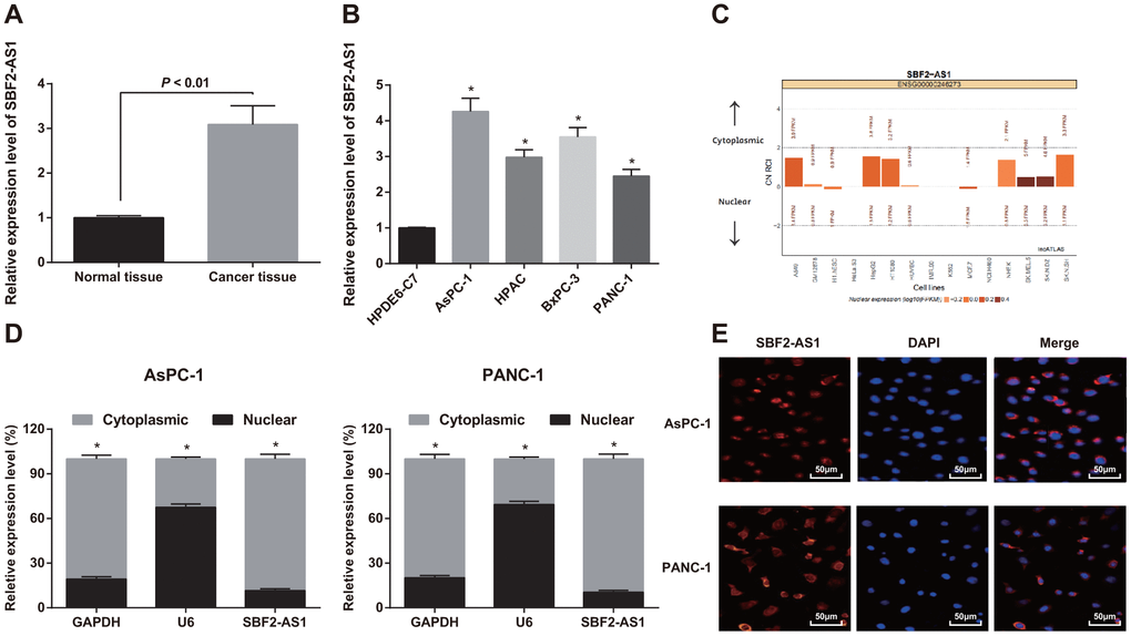 Expression of SBF2-AS1 in pancreatic cancer tissues and cells. (A) Detection of SBF2-AS1 expression in pancreatic cancer and adjacent normal tissues by RT-qPCR, N = 82. (B) Detection of SBF2-AS1 expression in pancreatic cancer cells and normal cells by RT-qPCR. (C) Bioinformatics analysis to predict the expression localization of SBF2-AS1. (D) Detection of expression localization of SBF2-AS1 by nuclear and cytoplasmic separation assay. (E) FISH experiment to verify the expression localization of SBF2-AS1. Repetitions = 3; Data was analyzed using the t test or one-way ANOVA. * P 