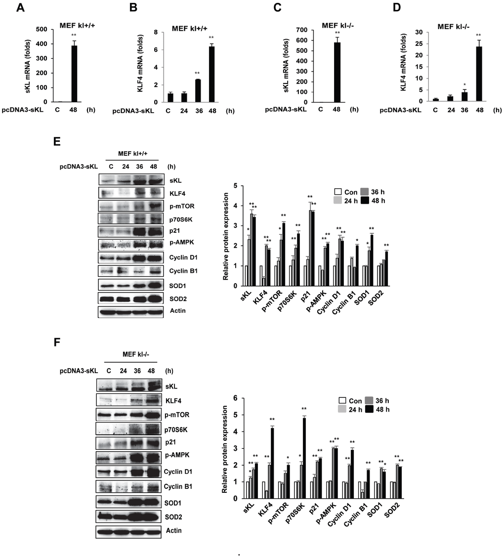 Effects of soluble klotho on the expression of proteins belonging to the KLF4 pathway in wild-type and klotho (-/-) MEFs. (A–D) qRT-PCR analysis of soluble klotho and KLF4. Total RNA samples were prepared from soluble klotho-transfected MEFs, and quantitative RT-PCR analysis was performed using the primers described. (E, F) The expression of proteins related to the KLF4 pathway. Wild-type and klotho (-/-) MEFs were transfected with soluble klotho expression plasmids (pcDNA3-soluble klotho). At 48 h after transfection, Western blot analysis was performed to assess the KLF4, mTOR, p70S6K, p21, AMPK, cyclin D1, cyclin B1, SOD1, and SOD2 levels. The mean ± S.D. of three independent experiments is shown (*p p 