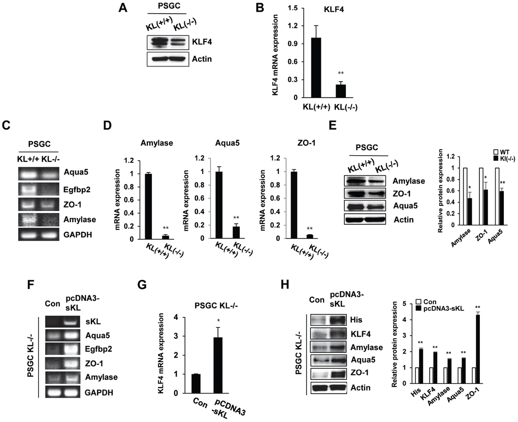 The expression of salivary gland functional proteins in primary salivary gland cells (PSGCs). (A, B) The protein and mRNA expression of KLF4 in KL(+/+) PSGCs and KL(-/-) PSGCs. (C–E) Comparison of functional protein or mRNA (aquaporin 5, EGFBP2, ZO-1, and amylase) expression between KL(+/+) PSGCs and KL(-/-) PSGCs by RT-PCR, qRT-PCR, and immunoblot analyses. (F–H) Effects of soluble klotho on functional protein expression. Cells were transfected with pcDNA3-soluble klotho for 48 h. Comparisons of salivary gland functional proteins by RT-PCR, qRT-PCR, and Western blot. The actin protein was used as an internal control. The results are reported as the mean ± SD (*p p 