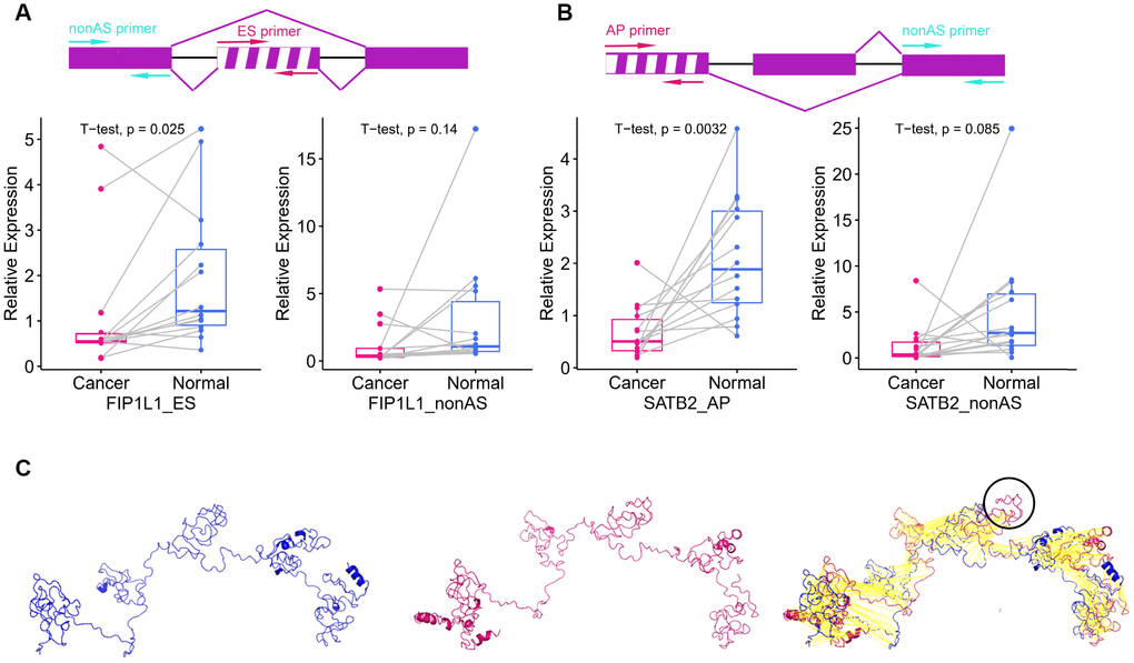 Survival-associated DEAS events expression in colon cancer and protein structure prediction. (A) The schematic diagram (top panel) depicts the ES of FIP1L1, where exon sequences are denoted by boxes and intron sequences are denoted by a horizontal line. The excluded exon is marked with a white stripe. The pair of red arrows indicates the primers amplifying the excluded exon, while the pair of cyan arrows indicates the primers amplifying the common exon among the different isoforms. The left panel displays the expression of FIP1L1-ES in cancer and adjacent tissues. The right panel displays the expression of FIP1L1 in cancer and adjacent tissues. (B) The schematic diagram (top panel) depicts the AP of SATB2, where exon sequences are denoted by boxes and intron sequences are denoted by a horizontal line. The excluded exon is marked with a white stripe. The pair of red arrows indicates the primers amplifying the excluded exon, while the pair of cyan arrows indicates the primers amplifying the common exon among the different isoforms. The left panel displays the expression of SATB2-AP in cancer and adjacent tissues. The right panel displays the expression of SATB2 in cancer and adjacent tissues. (C) Predicted structures of FIP1L1. The shorter variant (left panel) and longer variant (middle panel) were predicted by I-TASSER. The black circle in the right panel indicates the structure that could not be aligned.