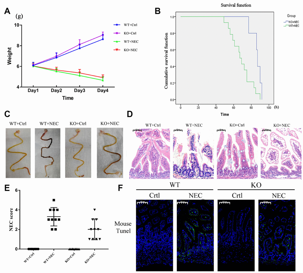 Targeted deletion of β-arrestin-2 impeded the development of NEC. (A) The body weights of mice decreased more slowly in the KO+NEC group (red) than in the WT+NEC group (green) (n=20). (B) The survival rate was much higher in the KO+NEC group (blue) than in the WT+NEC group (green) (n=20). (C) Representative images of gross morphology demonstrate that edema, congestion, necrosis and reddish-black coloring were more severe in the WT+NEC group than in the KO+NEC group. (D) Representative images display the more serious histological changes in the WT+NEC group, including the shedding of epithelial cells, necrosis of the entire villus and transmural necrosis. (E) The NEC score was lower in the KO+NEC group (2.00±1.05) than in the WT+NEC group (3.30±0.95) (P=0.01) (n=20). (F) A TUNEL assay revealed a much lower proportion of apoptotic cells in the KO+NEC group than in the WT+NEC group.