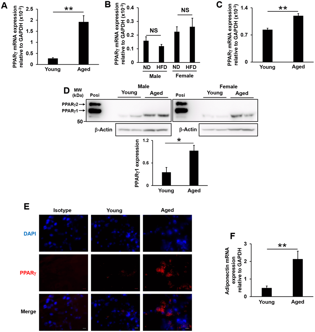 PPARγ expression in lacrimal glands and adiponectin mRNA expression in the white adipose tissue of aged and high-fat diet-fed mice. (A and B) PPARγ mRNA expression levels in the lacrimal glands of young and aged mice (N=7-8) (A), or of mice fed a normal diet (ND) or high-fat diet (HFD) for 8 weeks (N=4-5) (B). (C) PPARγ mRNA expression levels in the epithelial cells of the lacrimal glands of young and aged mice (N=4). (D) Detection of the PPARγ protein by Western blotting. Lysates prepared from the lacrimal glands of young and aged mice were immunoblotted with anti-AdipoR2 and anti-β-Actin antibodies. Left and right images show male (N=2) and female mice (N=2), respectively. The positive control (Posi) is a lysate prepared from the subcutaneous fat of young mice. The bar graph shows integrated signal intensities in AdipoR2 normalized to that of β-Actin (N=4). (E) PPARγ expression in the acinar cells of the lacrimal glands of young and aged mice as detected by immunofluorescence. Nuclei were stained with DAPI. Bars = 10 μm. (F) Adiponectin mRNA expression levels in the mesenteric white adipose tissues of young and aged mice (N=4-5). Values are presented as means ± SEM. NS, not significant. **pt-test).