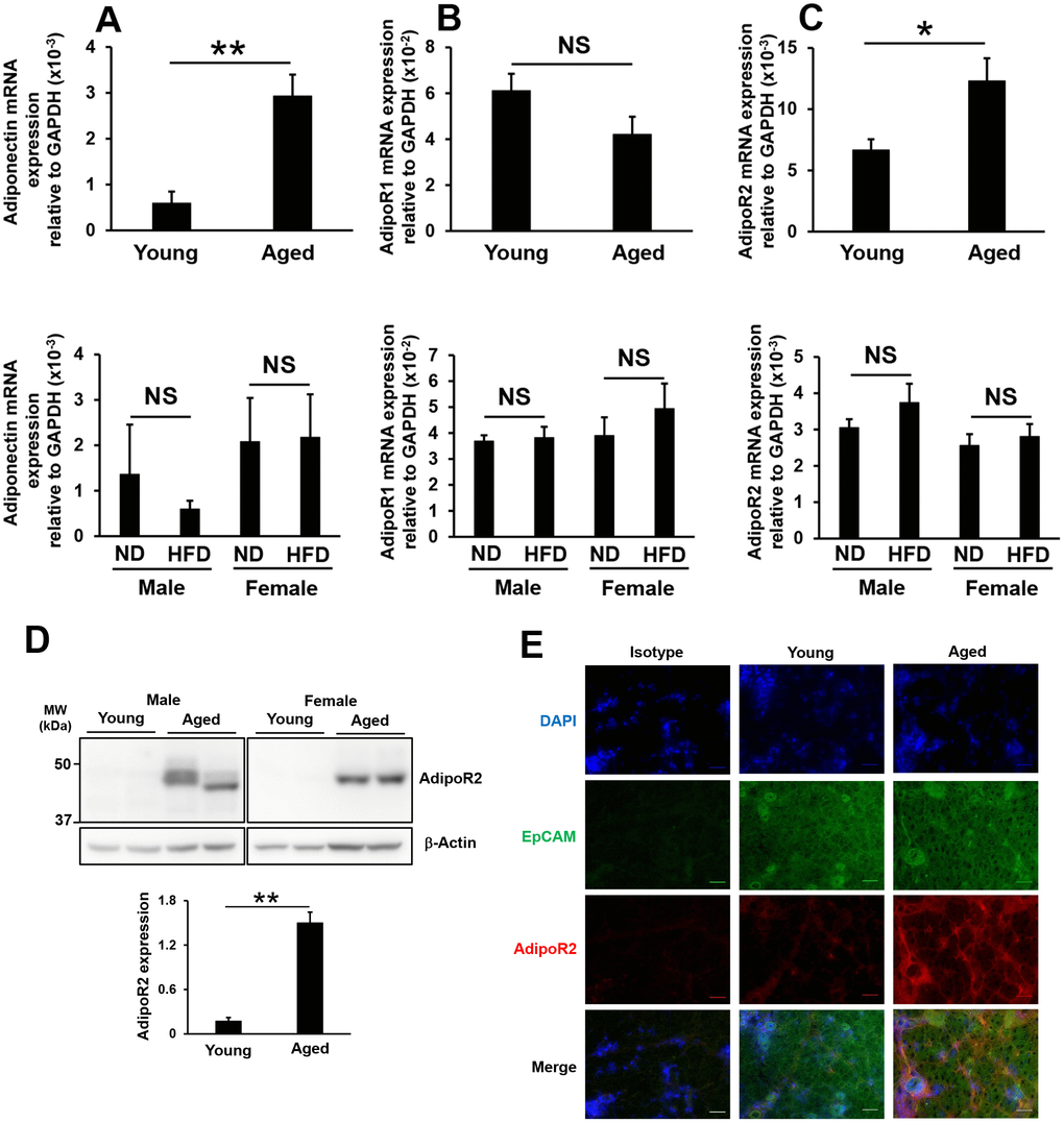 Influence of aging or high-fat diet feeding on adiponectin, adipoR1, and adipoR2 expression in lacrimal glands. Adiponectin (A), adipoR1 (B), and adipoR2 (C) mRNA expression levels in lacrimal glands. Upper and lower graphs show results in young and aged mice (N=7-8), and in mice fed a normal diet (ND) or high-fat diet (HFD) for 8 weeks (N=4-5), respectively. (D) Detection of the AdipoR2 protein by Western blotting. Lysates prepared from the lacrimal glands of young and aged mice were immunoblotted with anti-AdipoR2 and anti-β-Actin antibodies. Left and right images show male (N=2) and female mice (N=2), respectively. The bar graph shows integrated signal intensities in AdipoR2 normalized to that of β-Actin (N=4). (E) AdipoR2 expression in the lacrimal glands of young and aged mice as detected by immunofluorescence. Nuclei were stained with DAPI. Bars = 40 μm. Values are presented as means ± SEM. NS, not significant. *pt-test).