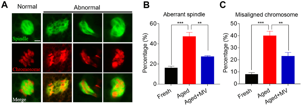 Effects of mogroside V on spindle formation and chromosome alignment in oocytes during in vitro ageing. After in vitro maturation for 44 h, oocytes that extruded the first polar body were continuously cultured in vitro with or without MV for 24 h. (A) Representative images of spindle morphologies and chromosome alignment in fresh, aged and aged+MV oocytes. (B) The percentage of aberrant spindle formation in fresh, aged and aged+MV oocytes. (C) The percentage of misaligned chromosomes in fresh, aged and aged+MV oocytes. The data are presented as the mean ± SEM of at least three independent experiments. MV, mogroside V; Scale bar = 7.5 μm. ** PP