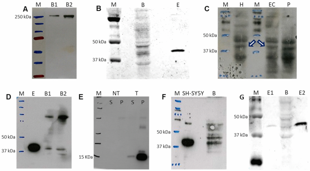 Western blot detection of selected proteins from the de novo pyrimidine biosynthesis pathway in adult human brain. (A) CAD protein in 40 and 80 μg of brain sample, B1 and B2, respectively. (B) DHODH protein in 180 μg of brain (B) protein using polyclonal antibody. Lane E: commercial DHODH enzyme lacking its 31 first amino acids (250 ng of protein). (C) DHODH protein in hippocampus (H, 100 μg of protein), entorhinal cortex (EC, 180 μg of protein) and putamen (P, 180 μg of protein) using polyclonal antibody. White arrows indicate the corresponding band for DHODH. (D) DHODH protein using monoclonal antibody for detection of commercial enzyme lacking its first 31 amino acids (E, 250 ng of protein) and in 40 and 80 μg of brain sample, B1 and B2, respectively. (E) Fragment of DHODH protein used as immunogen to produce the monoclonal antibody. NT and T homogenates of untransformed bacteria and bacteria transformed with the DHODH fragment sequence, respectively. S and P: supernatant and pellet, respectively. (F) DHODH protein in neuroblastoma SH-SY5Y cell line (70 μg of protein) and brain tissue (B, 250 μg of protein) using polyclonal antibody. (G) Quantification of brain DHODH protein with the polyclonal antibody in brain (B, 180 μg of protein) by comparison with the commercial enzyme lacking its first 31 amino acids at 0.4 and 4.0 ng (E1 and E2), respectively. M: molecular weight marker.