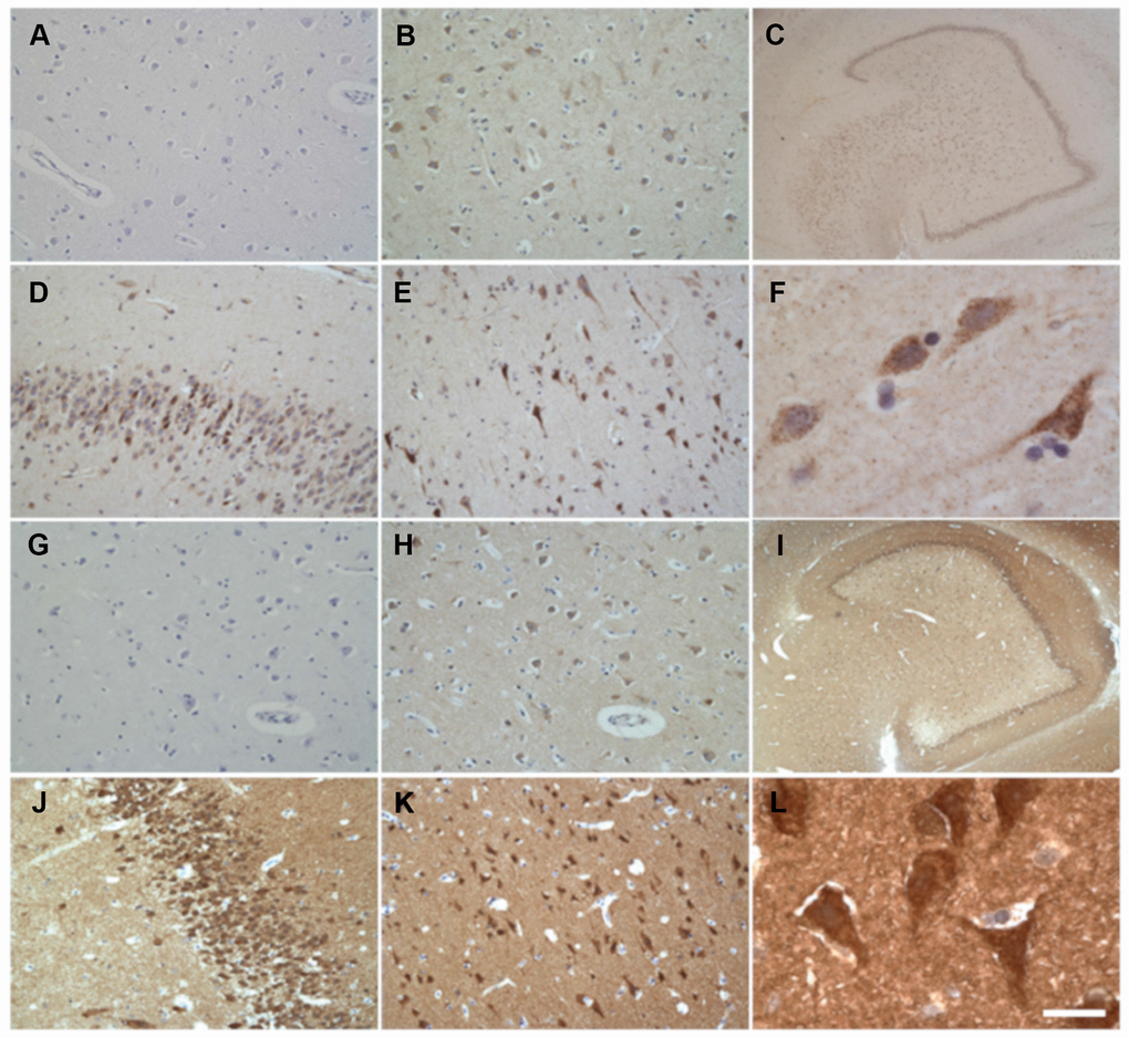 Immunohistochemical detection of neuronal CAD (A–F) and DHODH (G–L) in adult non-AD human brain. (A, G) Negative control. No primary antibody. (B, H) Positive control. (C, I) Dentate gyrus. (D, J) Granular layer of dentate gyrus. (E, K) Frontal cortex. (F, L) Entorhinal cortex. Scale bar in L represents 1000 μm in C and I; 100 μm in A, B, D, E, G, H, J and K; and 20 μm in F and L.