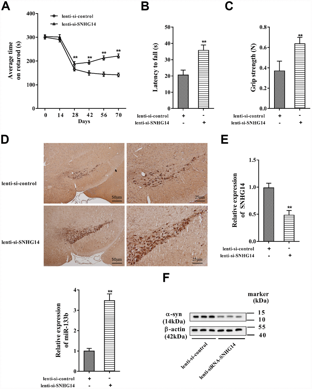Down-regulated SNHG14 mitigated neuron injury in PD mice. PD mice (n=7) were injected with lenti-si-control or lenti-si-SNHG14. The motor function of mice was assessed with (A) rotarod performance, (B) reversed screen test, and (C) forelimb grip strength test. (D) Immunohistochemistry staining was performed to determine the number of TH-positive DA neuron in the brain tissues of mice. (E) Relative expression of SNHG14 and miR-133b in brain tissues of mice was evaluated with qRT-PCR. (F) Level of α-syn and SP-1 protein in brain tissues of mice was assessed by western blotting. **P