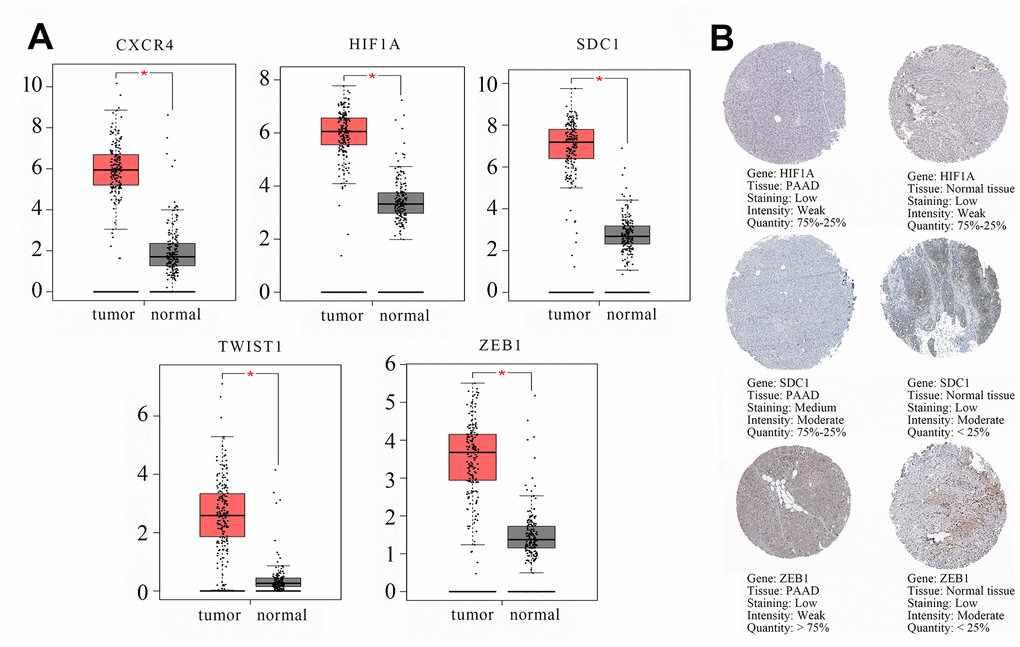 Validation of the transcript (mRNA) and protein levels of the hub genes using the Gene Expression Profiling Interactive Analysis (GEPIA) and The Human Protein Atlas database. (A) The transcript (mRNA) of the hub genes, namely, CXCR4, HIF1A, SDC1, TWIST1, and ZEB1 in PAAD and normal pancreatic tissues are shown. (B) Immunohistochemical (IHC) staining data of hub genes as follows: HIF1A protein expression in a PAAD tumor tissue (Staining: low; Intensity: weak; Quantity: 75%-25%; Location: cytoplasmic/membrane); HIF1A protein expression in a representative normal pancreatic tissue (Staining: low; Intensity: weak; Quantity: 75%-25%; Location: nuclear); SDC1 protein expression in a PAAD tumor tissue (Staining: medium; Intensity: moderate; Quantity: 75%-25%; Location: cytoplasmic/membrane). SDC1 protein expression in a representative normal pancreatic tissue (Staining: low; Intensity: moderate; Quantity: ZEB1 protein expression in a PAAD tumor tissue (Staining: low; Intensity: weak; Quantity: > 75%; Location: cytoplasmic/membrane). ZEB1 protein expression in a representative normal pancreatic tissue (Staining: low; Intensity: moderate; Quantity: CXCR4 and TWIST1 protein expression in PAAD tumor tissues and normal pancreatic tissues. IHC results consistent with changed trend of transcript (mRNA) of hub genes in GSE60980 (GPL14550) and GEPIA were displayed.