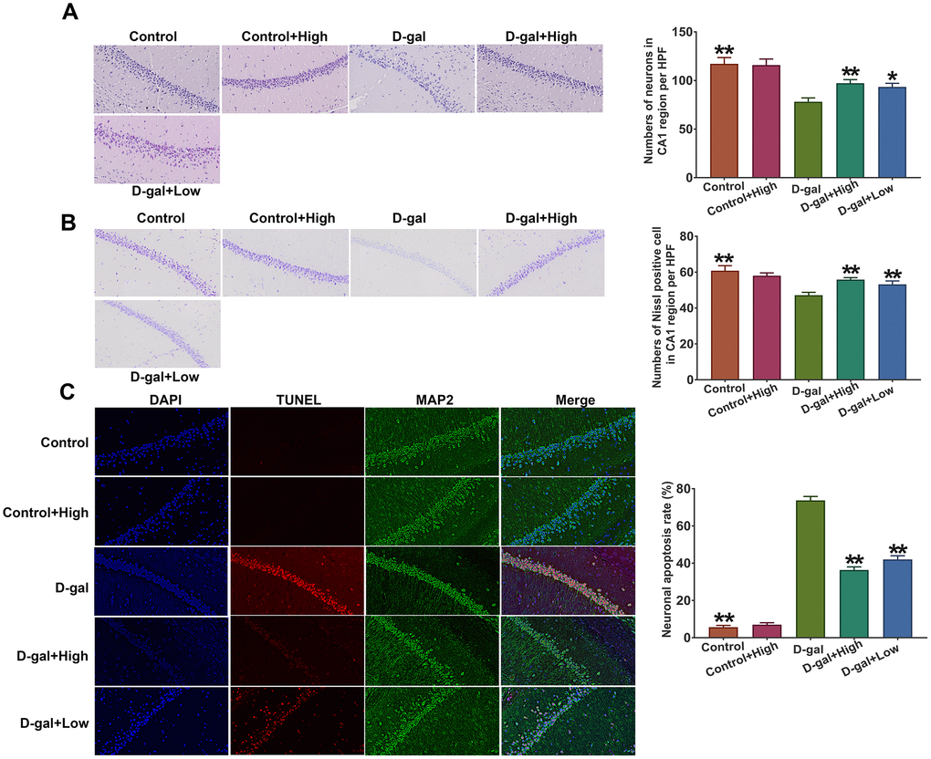 Prob treatment alleviates hippocampal neuronal loss in D-gal-induced aging mice. (A) H&E staining. (B) Nissl staining. (C) Cell apoptosis was detected by the TUNEL assay. The representative sections of hippocampal CA1 region were chosen and used to quantify positive cell numbers by a blinded observer. Data in each experiment represent mean ± SEM from 4-5 independent samples. Statistically significant differences were calculated by one-way ANOVA using the SPSS 20.0 software. *PP