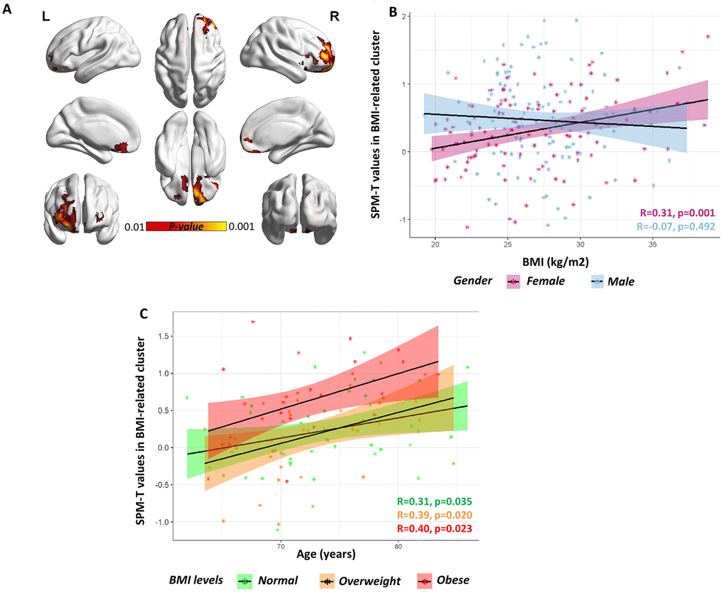 Gender-specific voxel-wise correlation between BMI levels and brain metabolism. (A) A significant positive correlation was found in orbitofrontal regions (partial R=0.44) in females. Statistical threshold was set at phttp://www.nitrc.org/projects/bnv/) was used for rendering [52]. (B) Scatter plot shows the significant BMI by gender interaction on orbitofrontal metabolism, with females showing a significant positive correlation between BMI levels (x axis) and average SPM-T values of glucose metabolism (y axis) (R=0.31, pC) Scatter plot shows the lack of a significant BMI by age interaction on orbitofrontal metabolism, despite of a significant principal effect of age (partial R=0.32, p