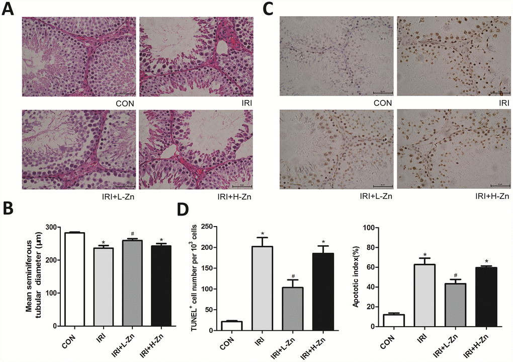 Zinc prevented testicular ischemia-reperfusion (I/R) injury in rats. (A) H&E staining of testicular tissues in Control, I/R injury, and I/R injury treated with Zinc rats (×400). Among them, ① Control group (n=8), ② I/R group (n=8), ③ Low-dose Zinc+I/R group (n=8), ④ High-dose Zinc group+I/R (n=8). (B) Mean seminiferous tubular diameter (MSTD) in each group. (C) TUNEL assay of testicular tissues in each group. Apoptotic cells exhibit a brown nuclear stain under microscope (×400). (D) TUNEL positive cells per 103 germ cells and Apoptotic index of testes in each group. Data are shown as mean ± SD. *significant difference vs. Control group (P); #significant difference vs. I/R group (P