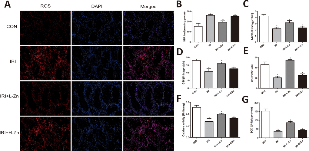 Zinc alleviated I/R induced oxidative damage in testis tissues. (A) DHE staining of testicular tissues in Control, I/R injury, and I/R injury treated with Zinc group. ROS exhibited red fluorescence under fluorescent microscope. (B–G) Content of MDA, T-AOC, GSH, GSH/GSSG, GST and SOD of testicular tissues in each group. Data are expressed as mean±SD. *significant difference vs. Control group (P); #significant difference vs. I/R group (P).