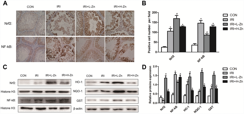Zinc pre-treatment increased the expression levels of Nrf2 and its downstream target genes in testicular tissues. (A) Immunohistochemical Staining showed Nrf2 and NF-κB expression levels in Control, I/R injury and I/R injury treated with Zinc groups. (B) Statistical analyses of IHC results in Nrf2 and NF-κB expression levels in different groups. (C) Protein levels of Nrf2, NF-κB, HO-1, NQO-1 and GST in different groups. Histone H3 and β-actin were used as a protein control to normalize volume of protein expression. (D) Statistical analyses of Western Blotting results in Nrf2, NF-κB, HO-1, NQO-1 and GST protein levels in different groups. Data are expressed as mean± SD. *significant difference vs. Control group (P#significant difference vs. I/R group (P).
