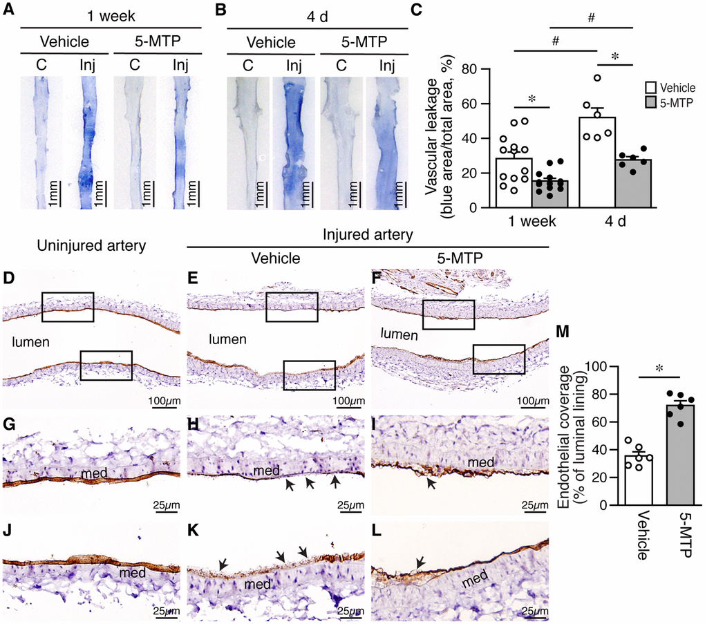 5-MTP reduces vascular leakage and increases endothelial coverage after arterial denudation. (A–B) Vascular leakage was assessed by Evans blue dye perfusion after injury. (C) contralateral uninjured right femoral artery; Inj, injured left femoral artery. (A) One week after injury (vehicle, n=13; 5-MTP, n=13). (B) Four days after injury (vehicle, n=10; 5-MTP, n=8). (C) Quantitation of vascular leakage. *p#pD–F) CD31 immunohistochemistry for ECs (brown) of arteries from uninjured (D), injured-vehicle (E), and injured-5-MTP mice (F) 1 week after injury. (G–L) Magnified areas from upper and lower box of (D–F), respectively. Arrows, CD31-negative areas; med, media. (M) Quantitation of endothelial coverage 1 week after injury (*p