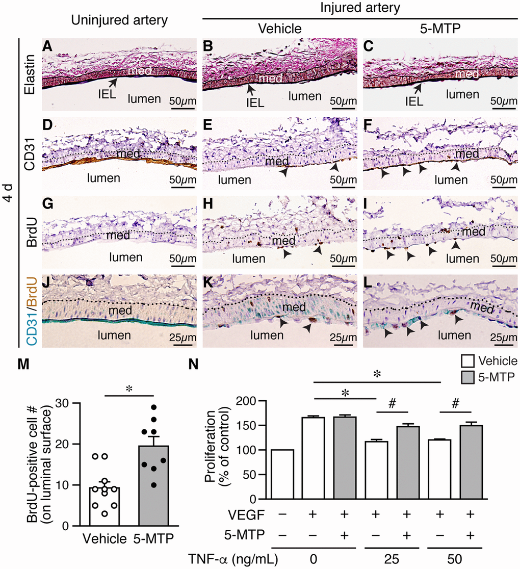 5-MTP increases endothelial proliferation following arterial denudation. Femoral arteries were harvested 4 d after injury. (A–C) Elastin stain of longitudinal vessel sections. Arrows, internal elastic lamina (IEL); med, media. (D–F) CD31 staining for ECs. Arrowheads, CD31-positive brown cells. (G–I) BrdU immunostaining for proliferating cells. Arrowheads, BrdU-positive brown nuclei. Dashed line, external elastic lamina. (J–L) Double immunostaining of CD31 (blue) and BrdU (brown). Arrowheads, double-positive cells. (M) Quantitation of BrdU-positive cells on the luminal surface of arteries from vehicle (n=10) and 5-MTP-treated mice (n=8; *pN) TNF-α decreased HUVEC proliferation induced by VEGF (n=4 each, *p#p