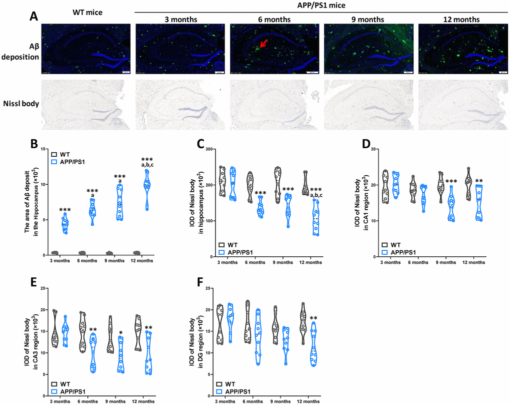 Age-related pathological deterioration in the hippocampus of APP/PS1 mice. Representative immunofluorescence staining images showing Αβ plaques (green and indicated by red arrows) and Nissl staining images showing Nissl bodies in the hippocampus of WT and APP/PS1 mice (A). Quantification of Αβ plaques(B) in the hippocampus of WT and APP/PS1 mice. Quantification of and Nissl bodies in the hippocampus (C), CA1 (D), CA3 (E) and DG (F) regions of WT and APP/PS1 mice. Quantitative analysis was used by Image Pro Plus 6.0 software. *PPPaPbPcP