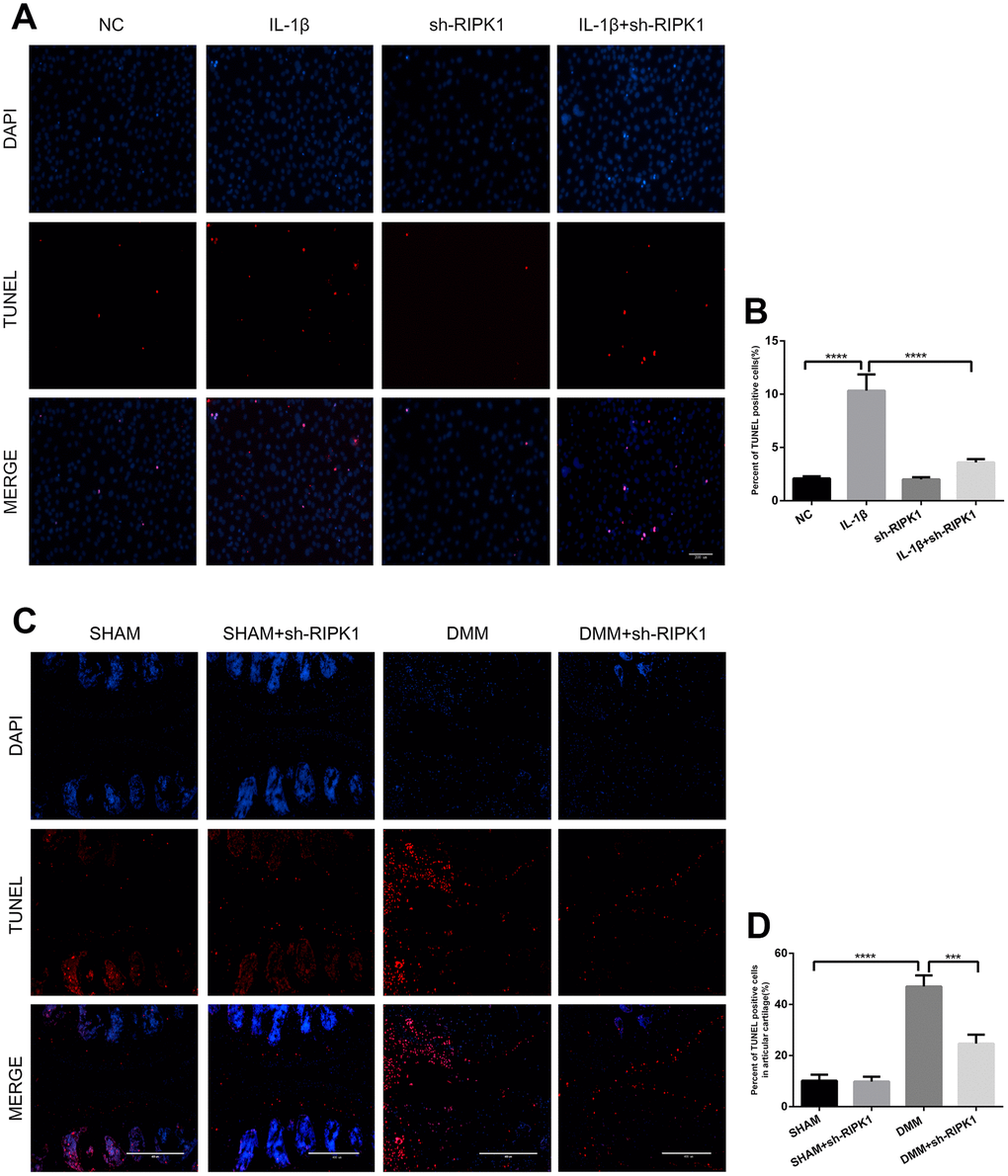 Knockdown of RIPK1 protects chondrocytes against apoptosis in vitro and in vivo. (A, B) Transferase dUTP nick-end labeling (TUNEL)-stained mouse chondrocytes treated as above; scale bar = 200 μm. (C, D) TUNEL-stained paraffin-wax sections of articular cartilage. Red fluorescence, apoptotic cells; blue fluorescence, nuclei (n = 10). Scale bar = 400 μm. The experiments were repeated three times independently. Columns represent means ± SD. ***p 