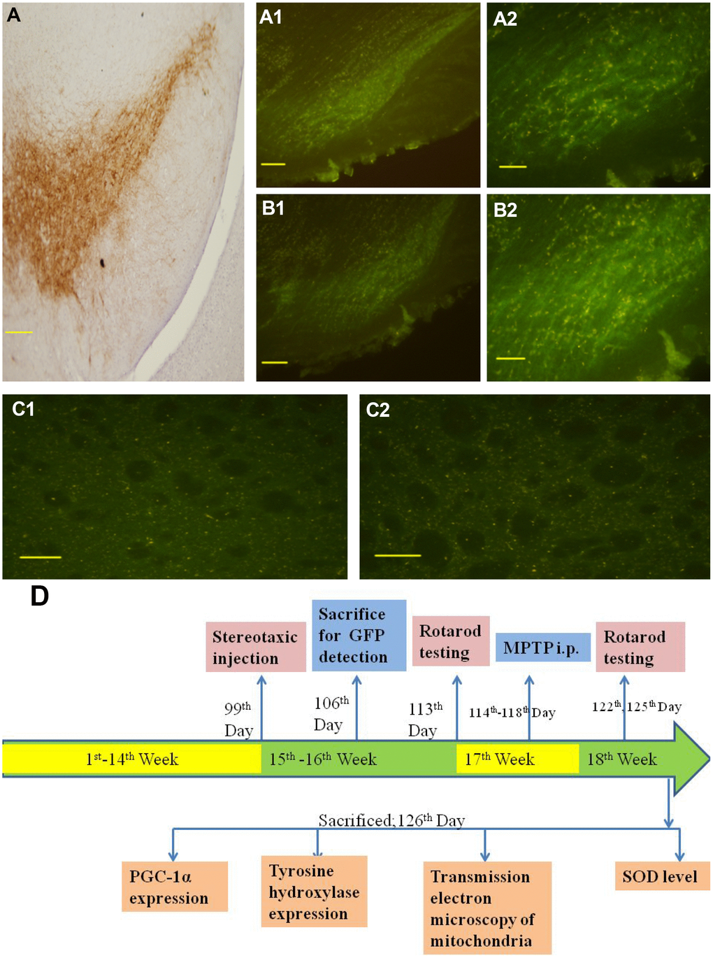 Distribution of lentivirus in the SN, striatum region and the representative schematic. (A) shows immunohistochemical staining of the substantia nigra in the control group. (A1 and A2) show successful LV-PGC-1α infection in the substantia nigra of mice. (B1 and B2) show successful LV-PGC-1α-siRNA infection of the substantia nigra of mice. (C1 and C2) show the striatum infected with LV-PGC-1α and LV-PGC-1α-siRNA, respectively. (D) shows a schematic representation of the experimental paradigm. Scale bar: 20 μm. Magnification: ×200 for A1, B1; ×400 for A, A2, B2, C1, C2.