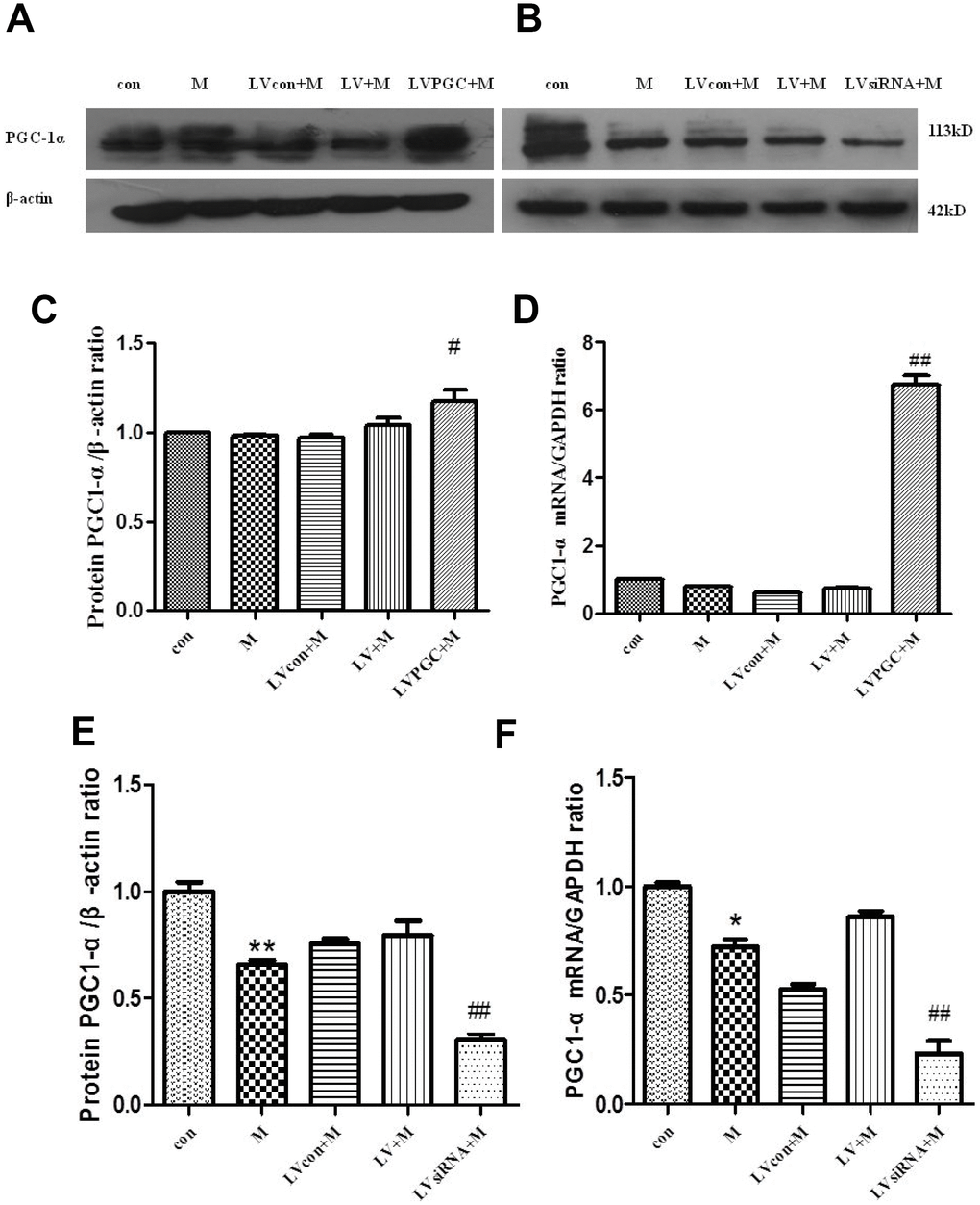 Expression of PGC-1α in the SN of C57BL mice. (A, B) PGC-1α protein expression patterns; (C, D) PGC-1α protein expression patterns after overexpression, detected using western blotting and real-time PCR; (E, F) PGC-1 α protein expression after knockdown, detected using western blotting and real-time PCR; Quantification of the results of three experiments are presented as the means ± SD. The groups were con (con group), M (MPTP group), LVcon+M (solvent of lentivirus+MPTP group), LV+M (lentivirus+MPTP group), LVPGC+M (LV-PGC-1α+MPTP group), LVsiRNA+M (LV-PGC-1αsiRNA+MPTP group); #P