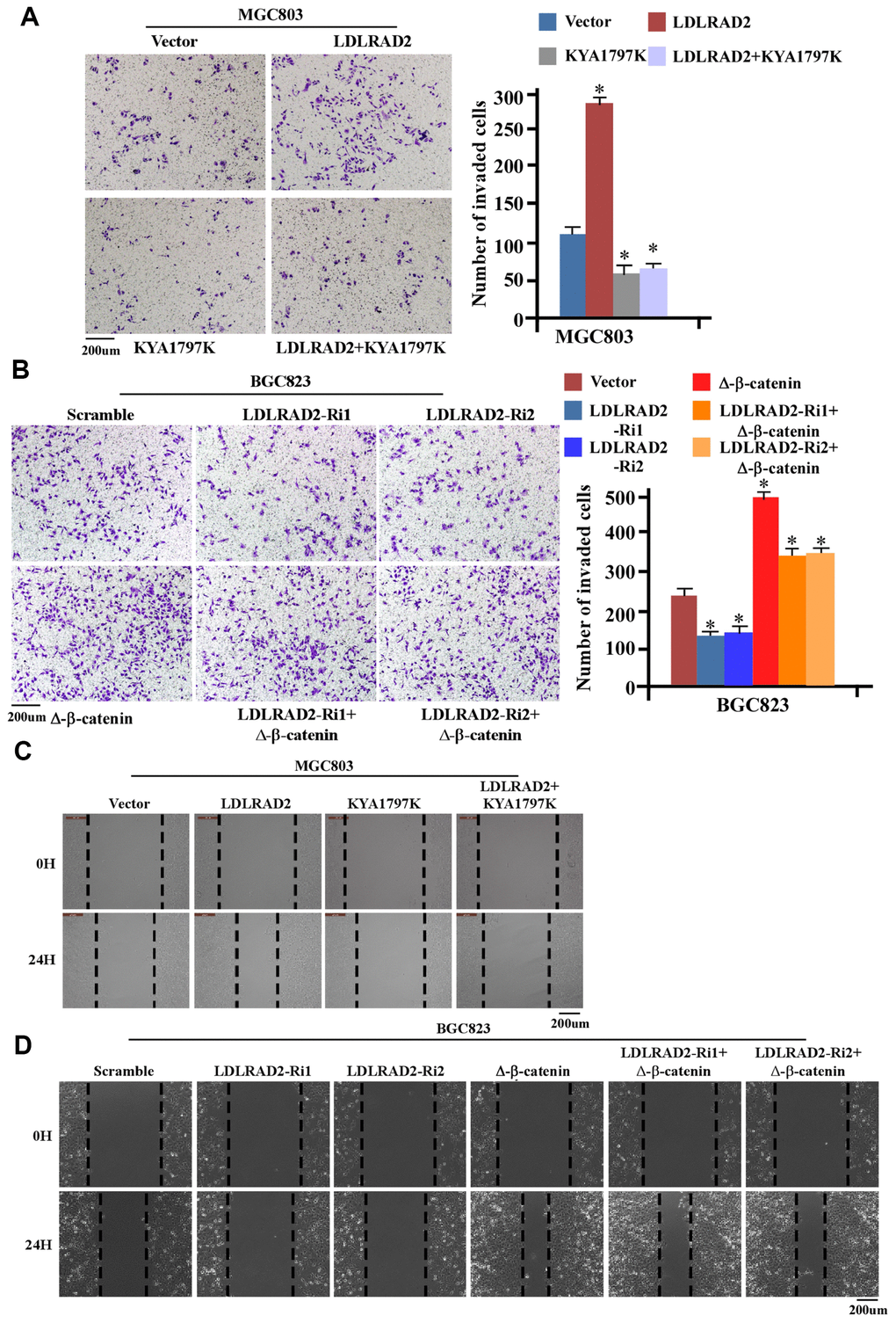 LDLRAD2-dependent activation of Wnt/β-catenin signaling promotes migration and invasion of GC cells. KYA1797 significantly inhibited the LDLRAD2-induced invasion of GC cells (A), while Δ-β-catenin markedly reversed the inhibitory effect of silence of LDLRAD2 on the invasion of GC cells (B). KYA1797 dramatically mitigated LDLRAD2-induced migration of GC cells (C), while Δ-β-catenin obviously reversed the inhibitory effect of silence of LDLRAD2 on the migration of GC cells (D).